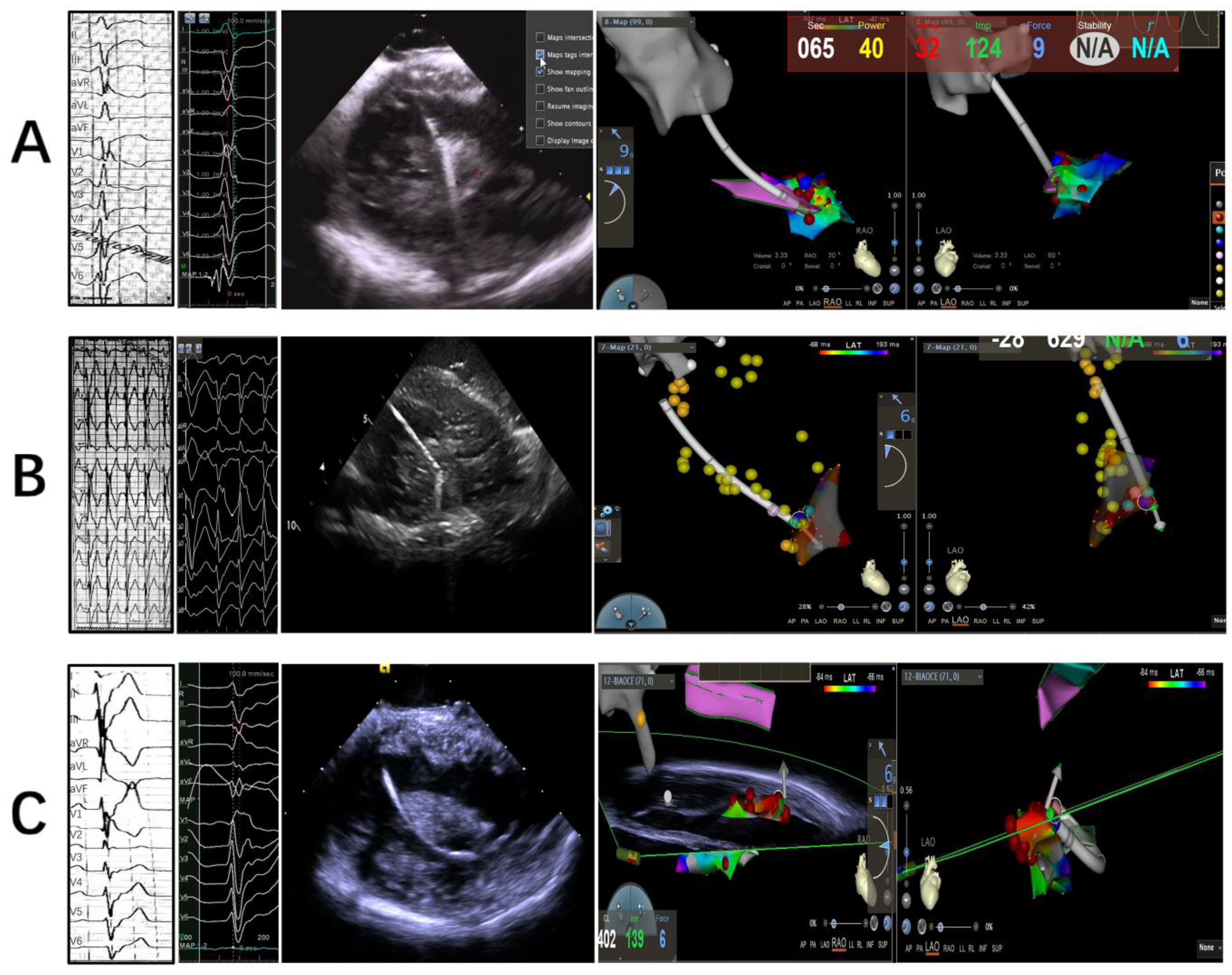 Jcm 12 03154 g005 Jcm 12 03154 g005