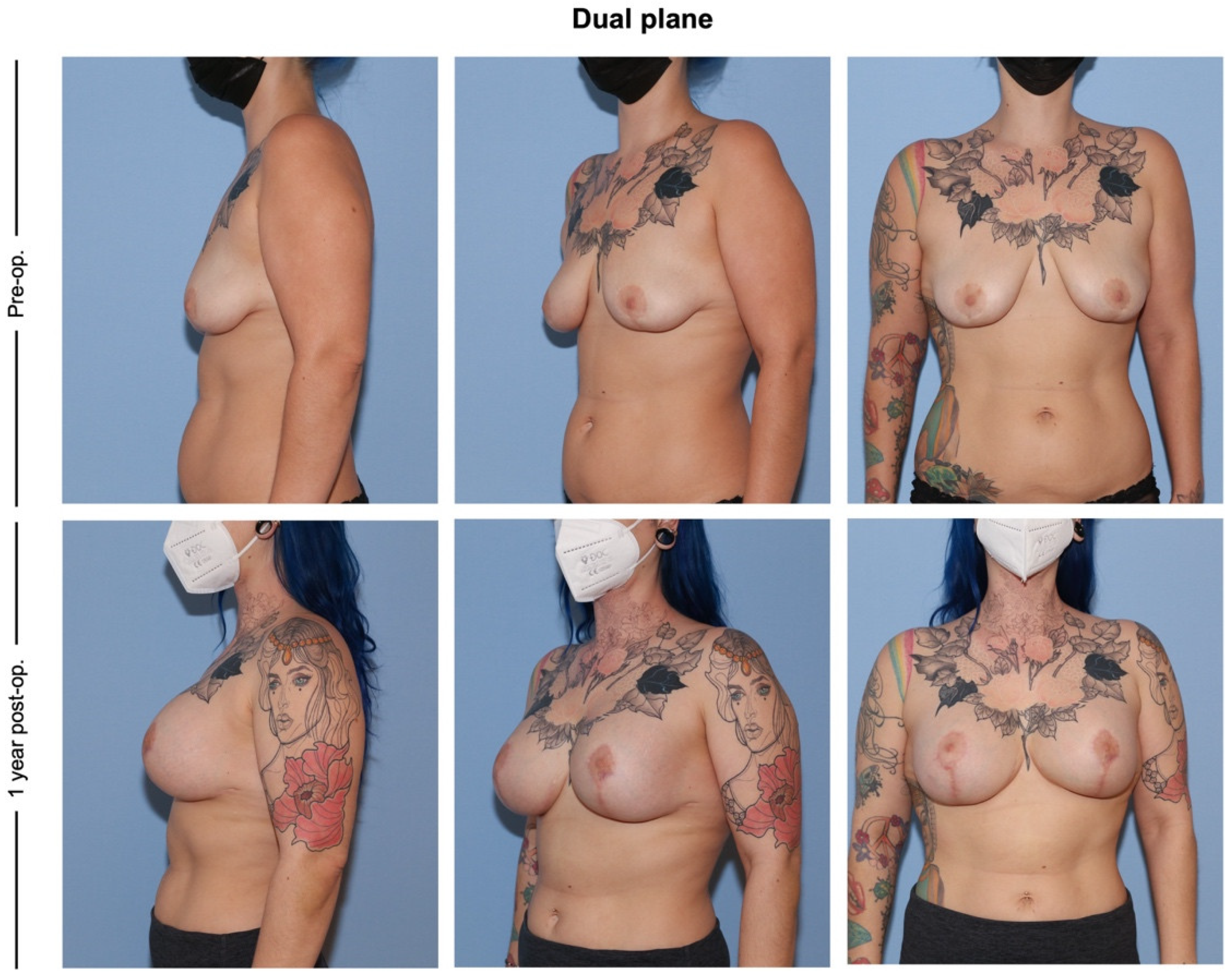 Jcm 12 03213 g003 550