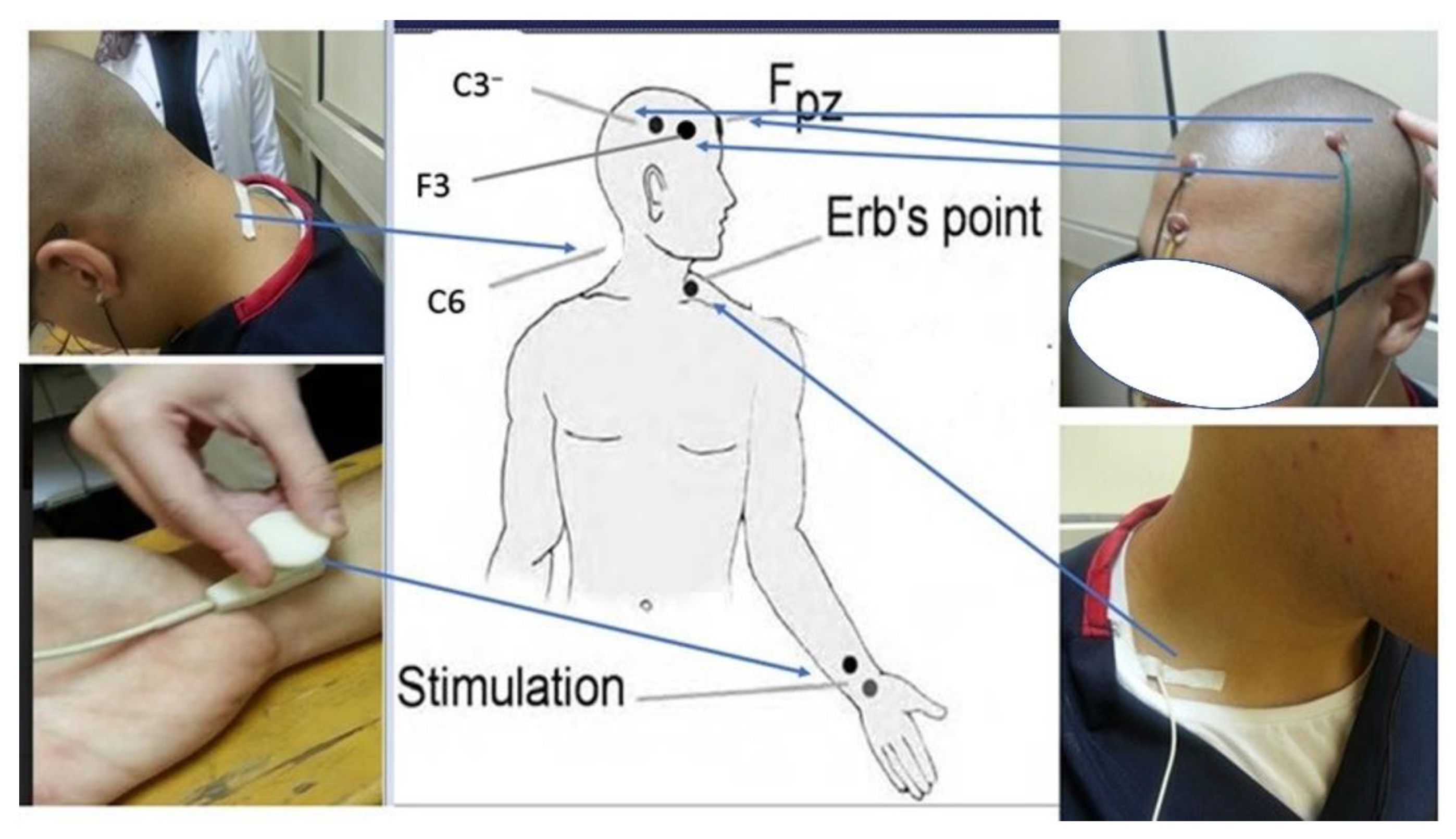 Jcm 12 03217 g002 Jcm 12 03217 g002