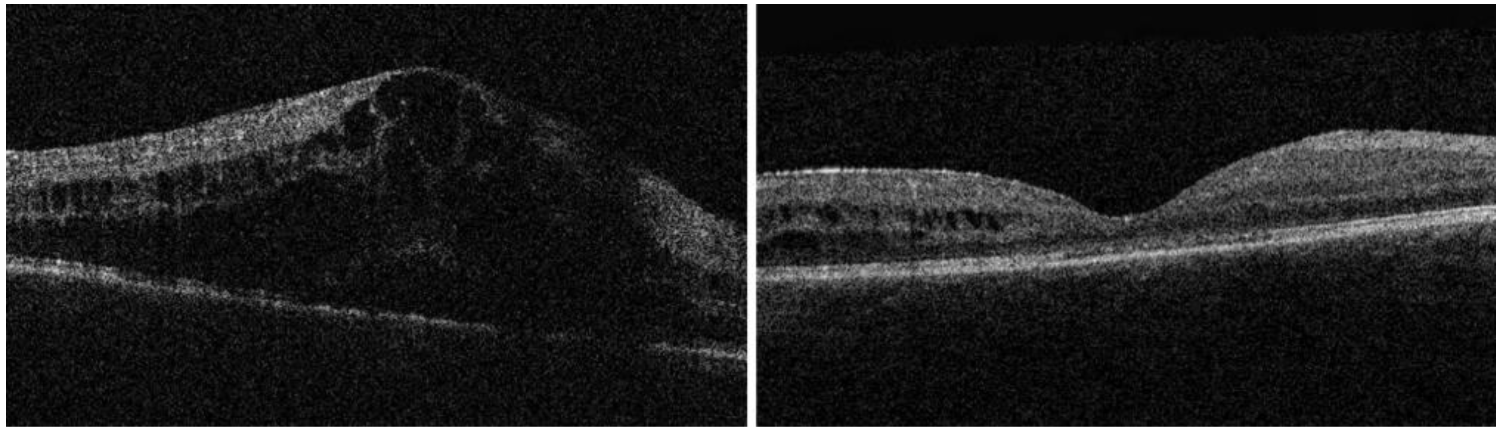 Jcm 12 03252 g001 Jcm 12 03252 g001