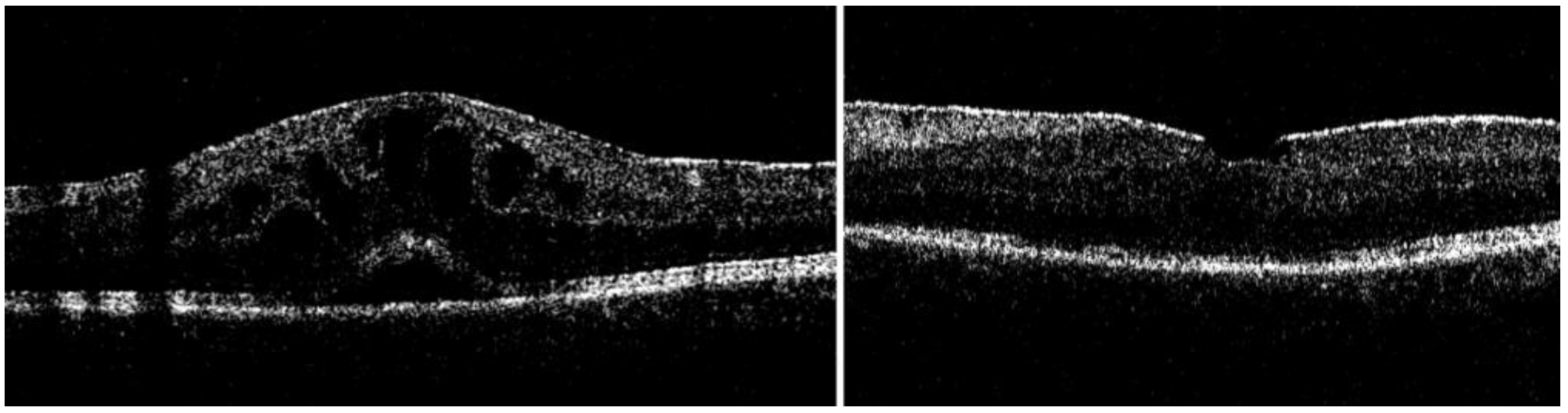 Jcm 12 03252 g002 Jcm 12 03252 g002