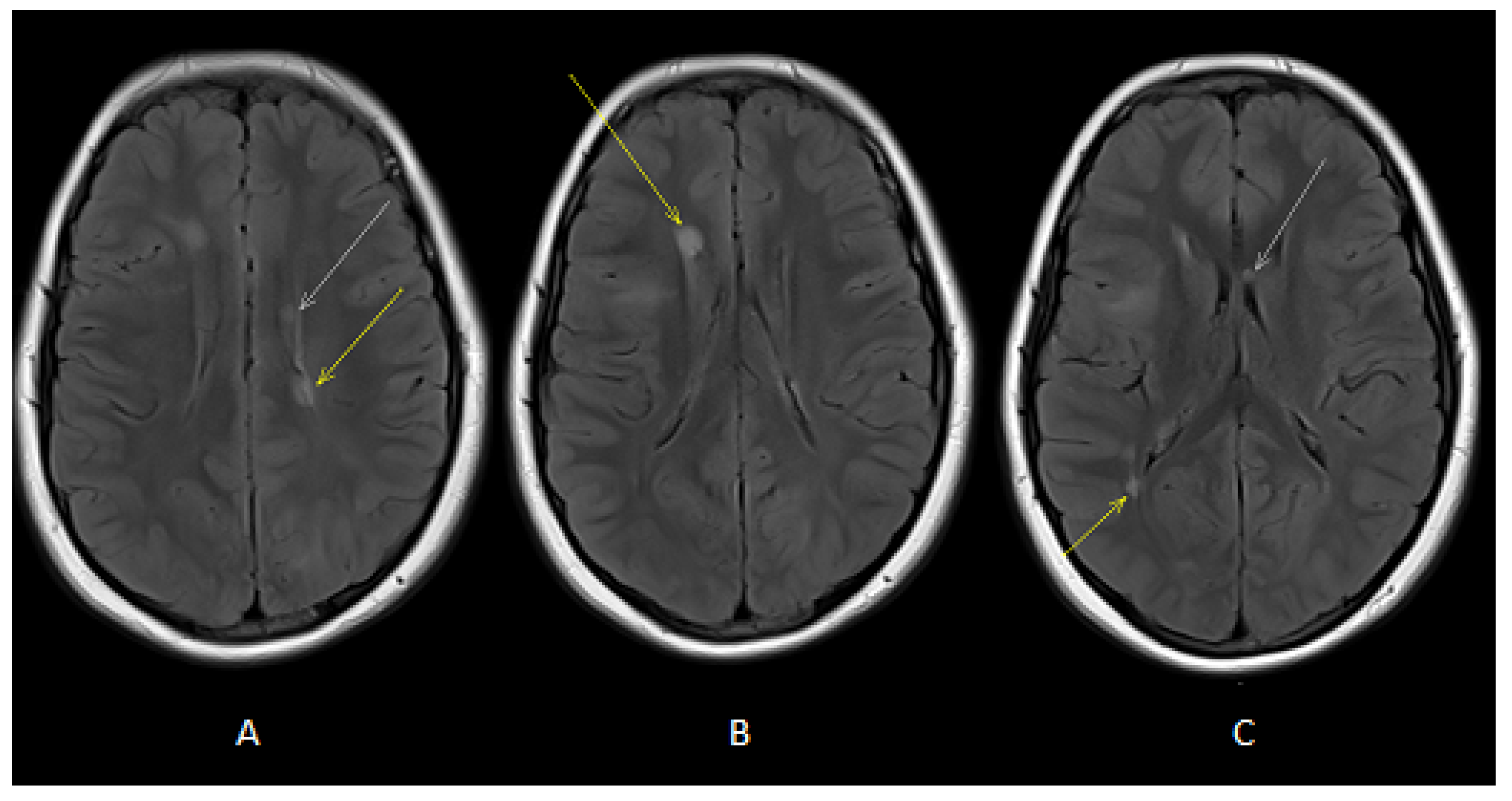 Jcm 12 03284 g002 Jcm 12 03284 g002