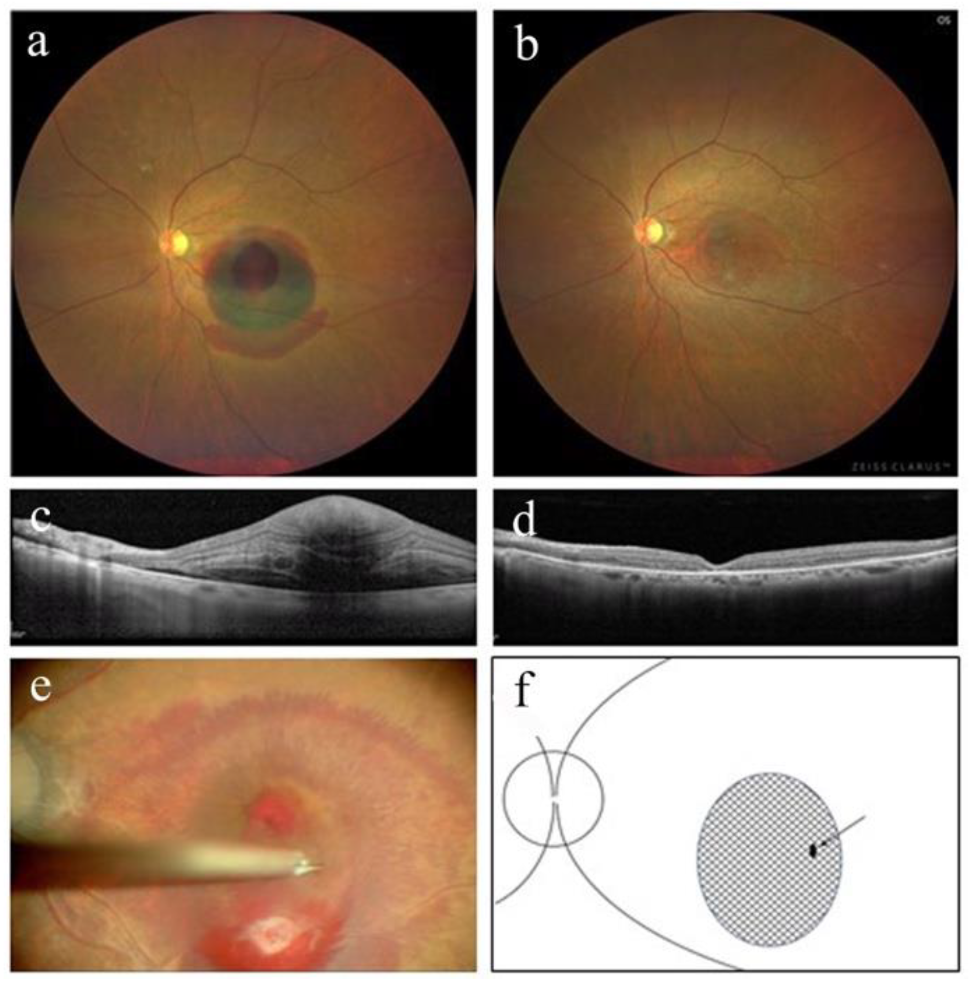 Jcm 12 03291 g003 Jcm 12 03291 g003