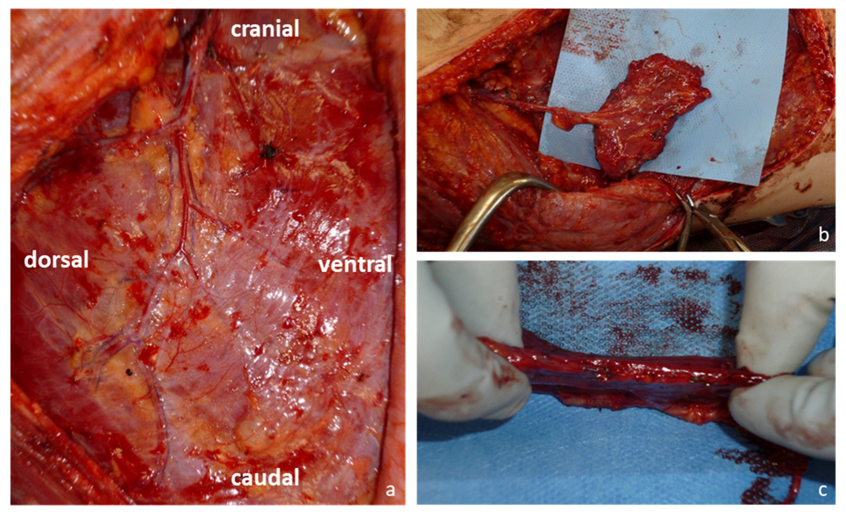 Jcm 12 03313 g001 Jcm 12 03313 g001