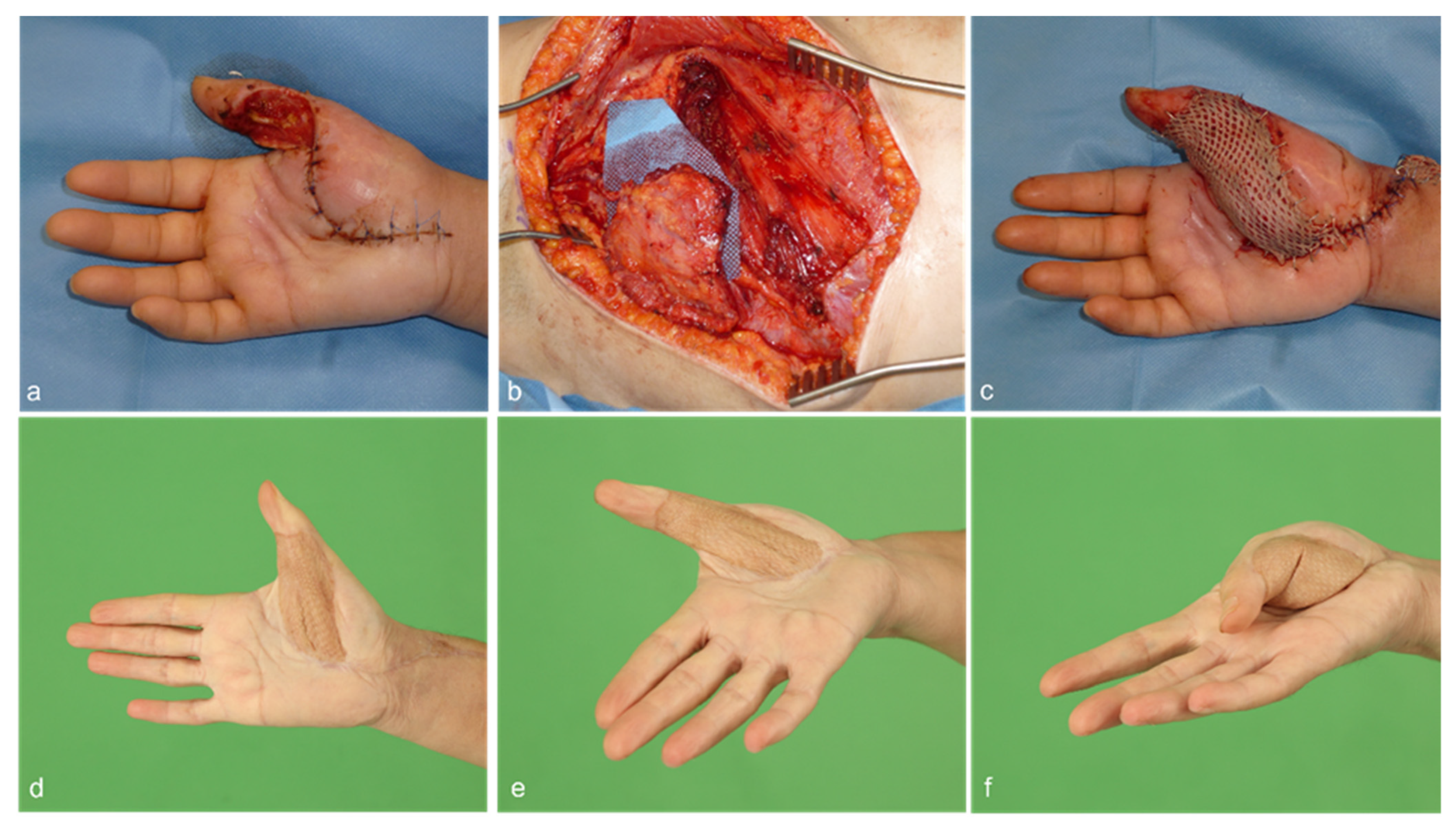 Jcm 12 03313 g002 Jcm 12 03313 g002