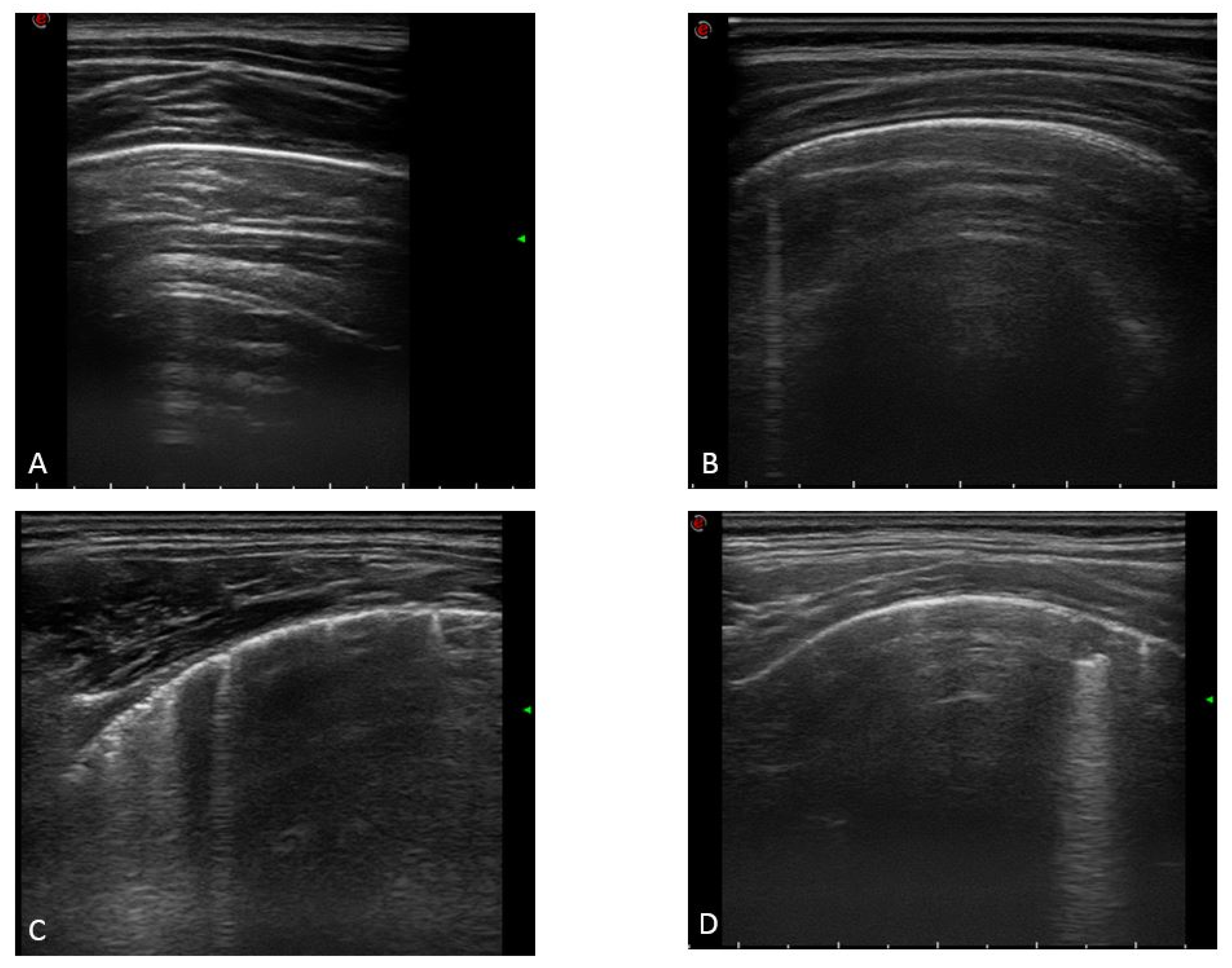 Jcm 12 03342 g001 Jcm 12 03342 g001