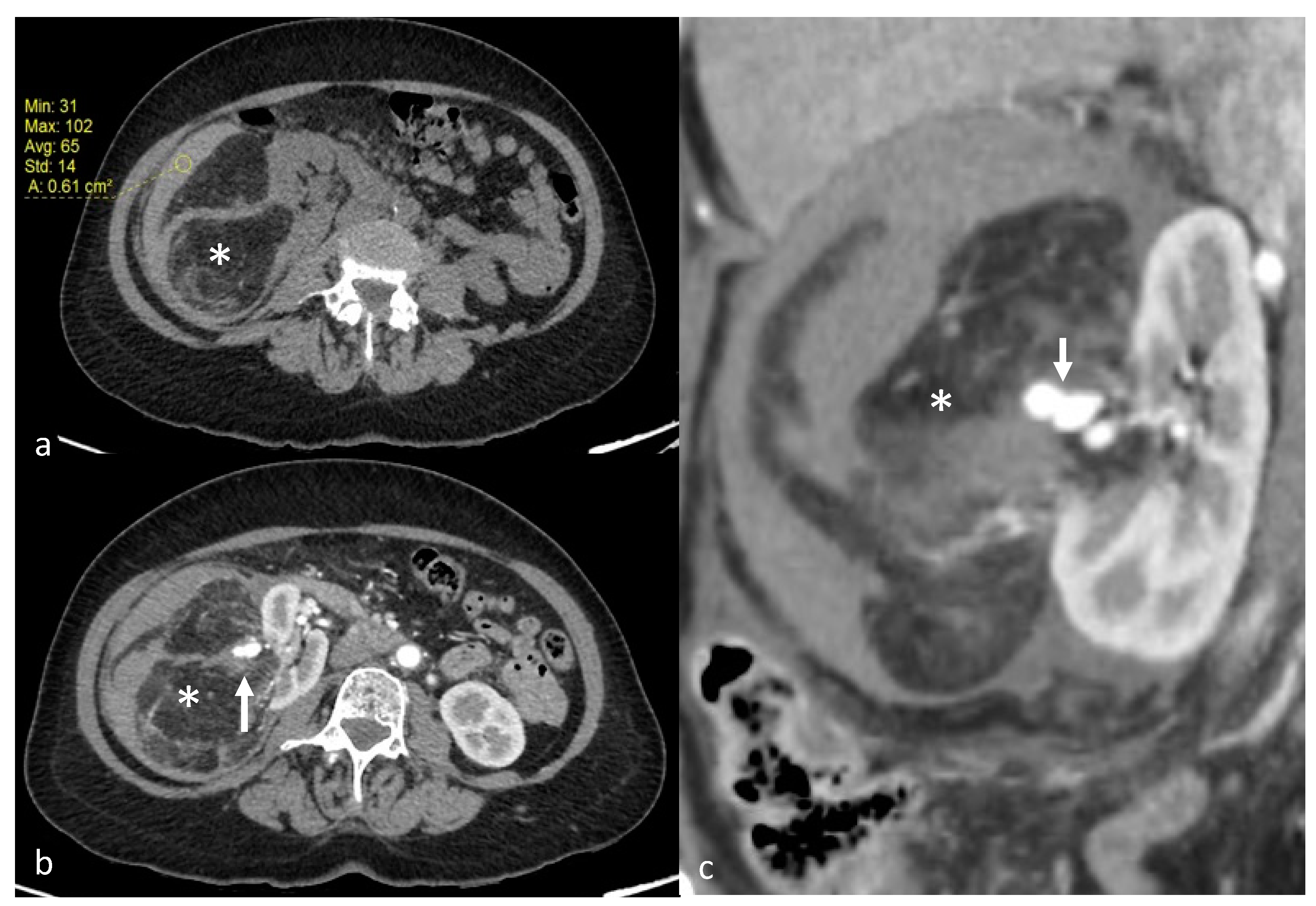 Jcm 12 03385 g001 Jcm 12 03385 g001