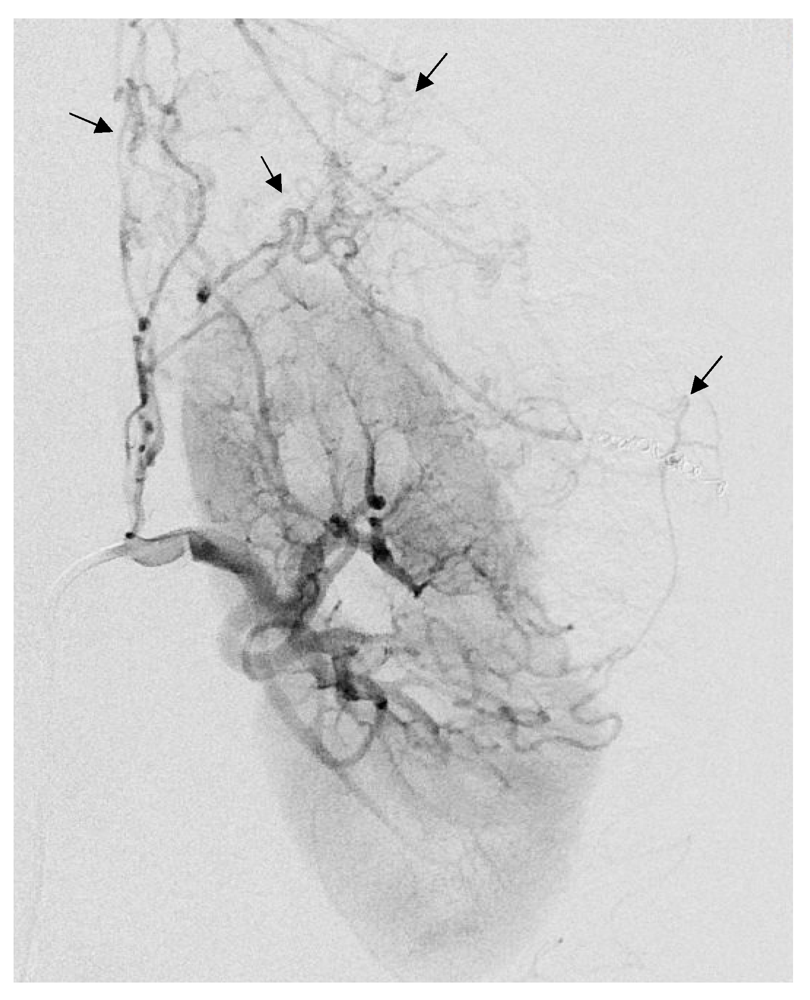Jcm 12 03385 g005 Jcm 12 03385 g005