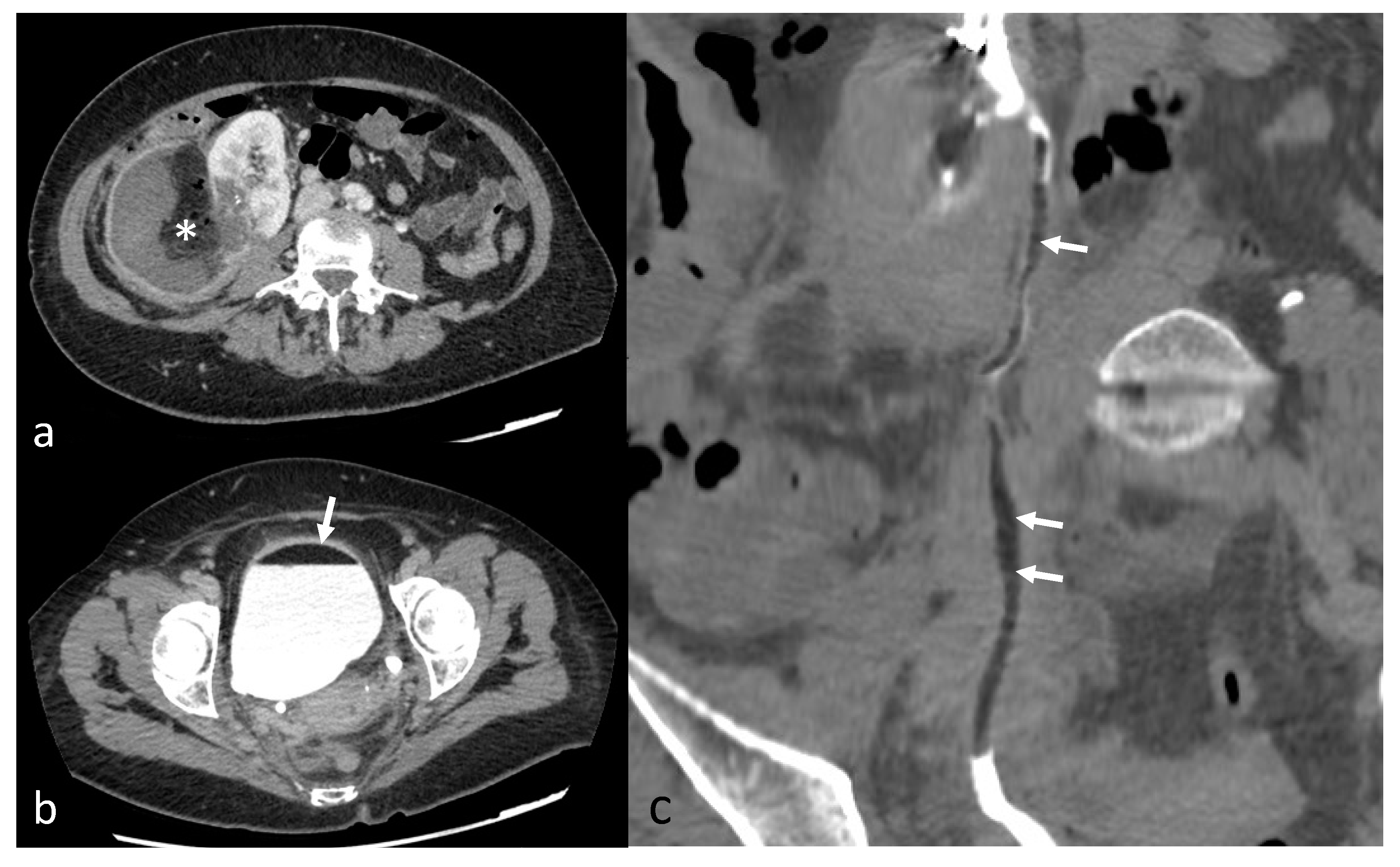 Jcm 12 03385 g006 Jcm 12 03385 g006