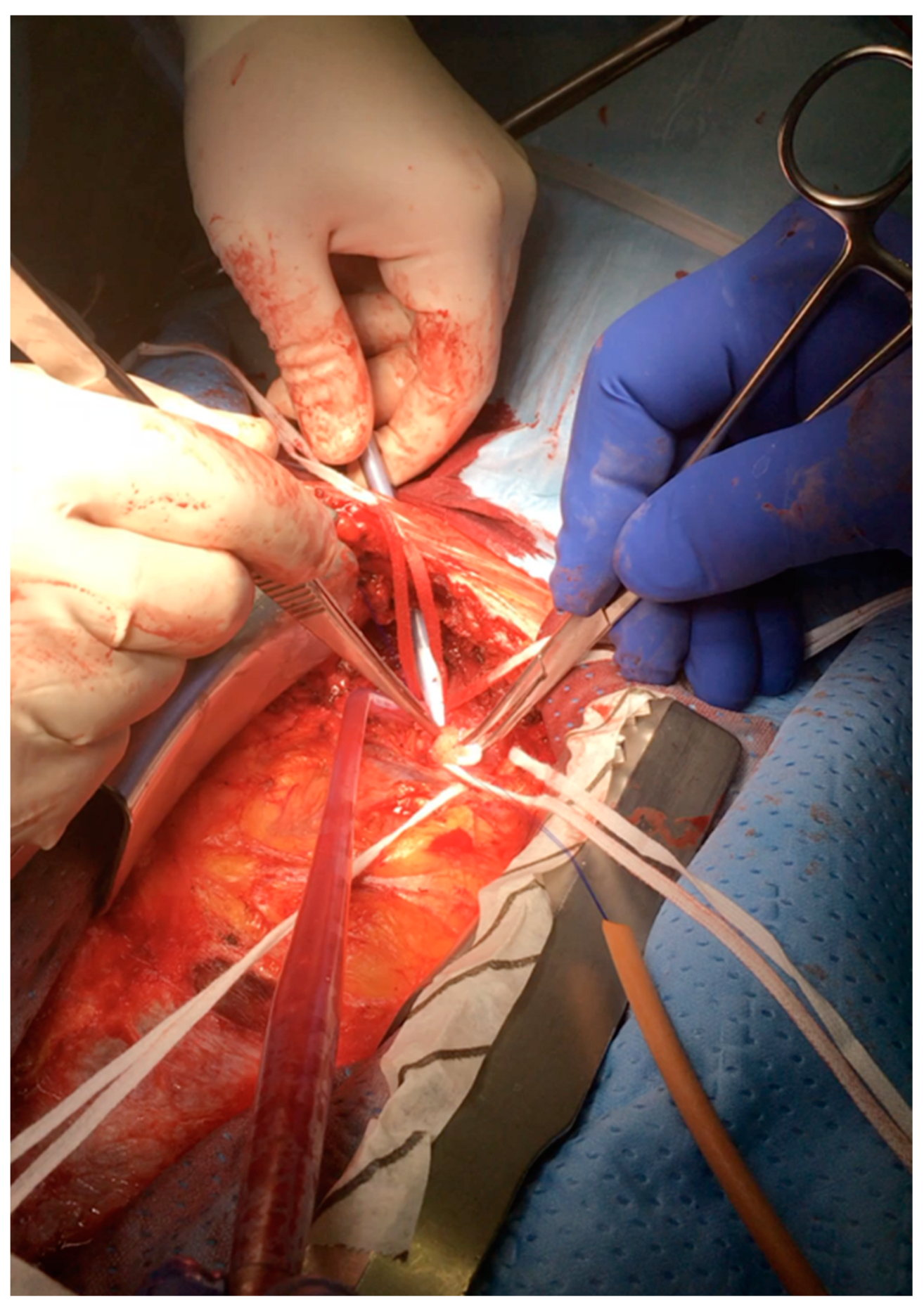 Jcm 12 03470 g001 Jcm 12 03470 g001