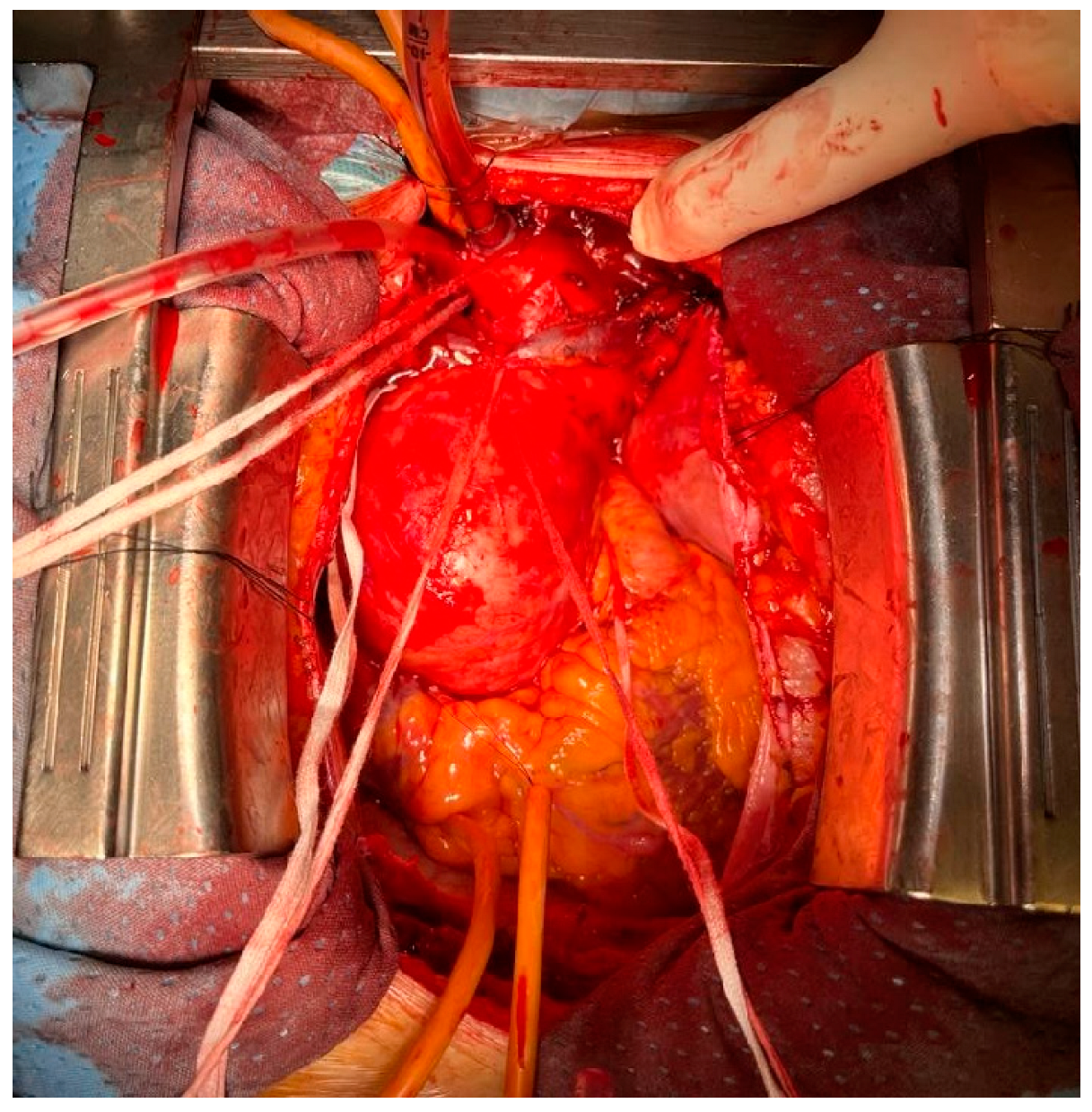 Jcm 12 03470 g002 Jcm 12 03470 g002