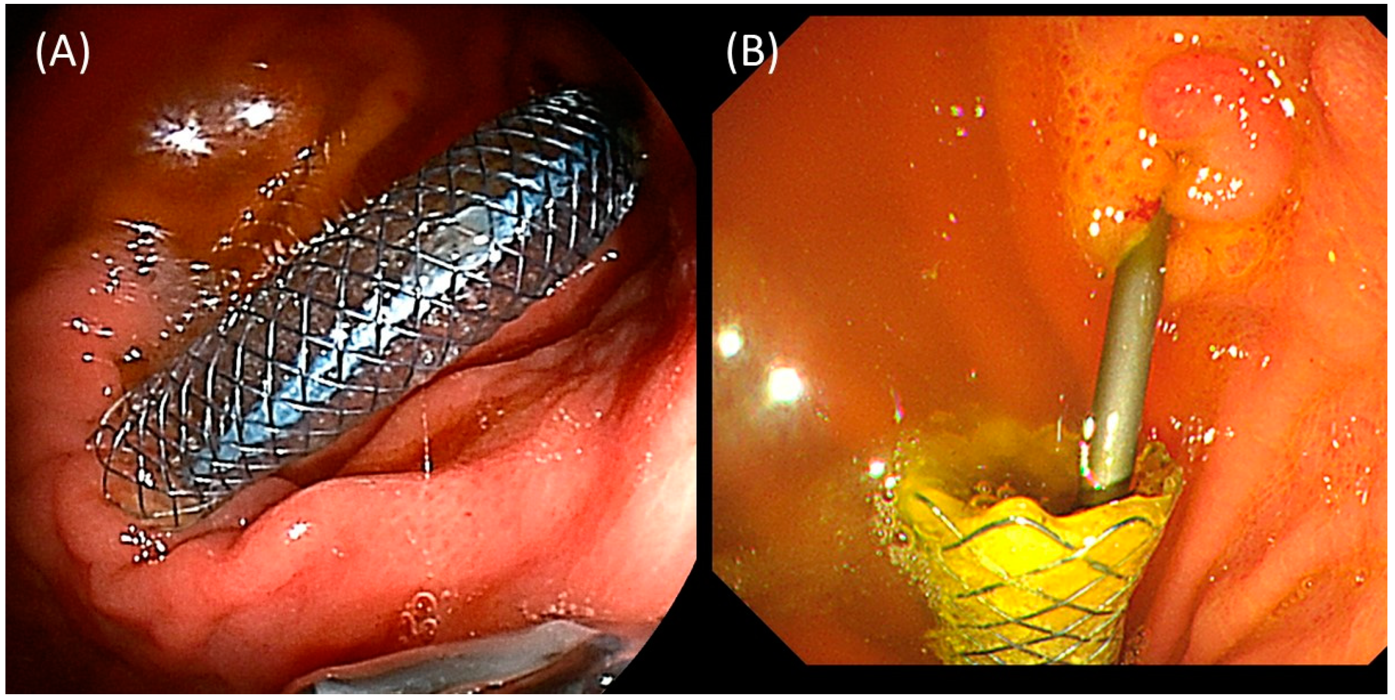 Jcm 12 03524 g002 Jcm 12 03524 g002