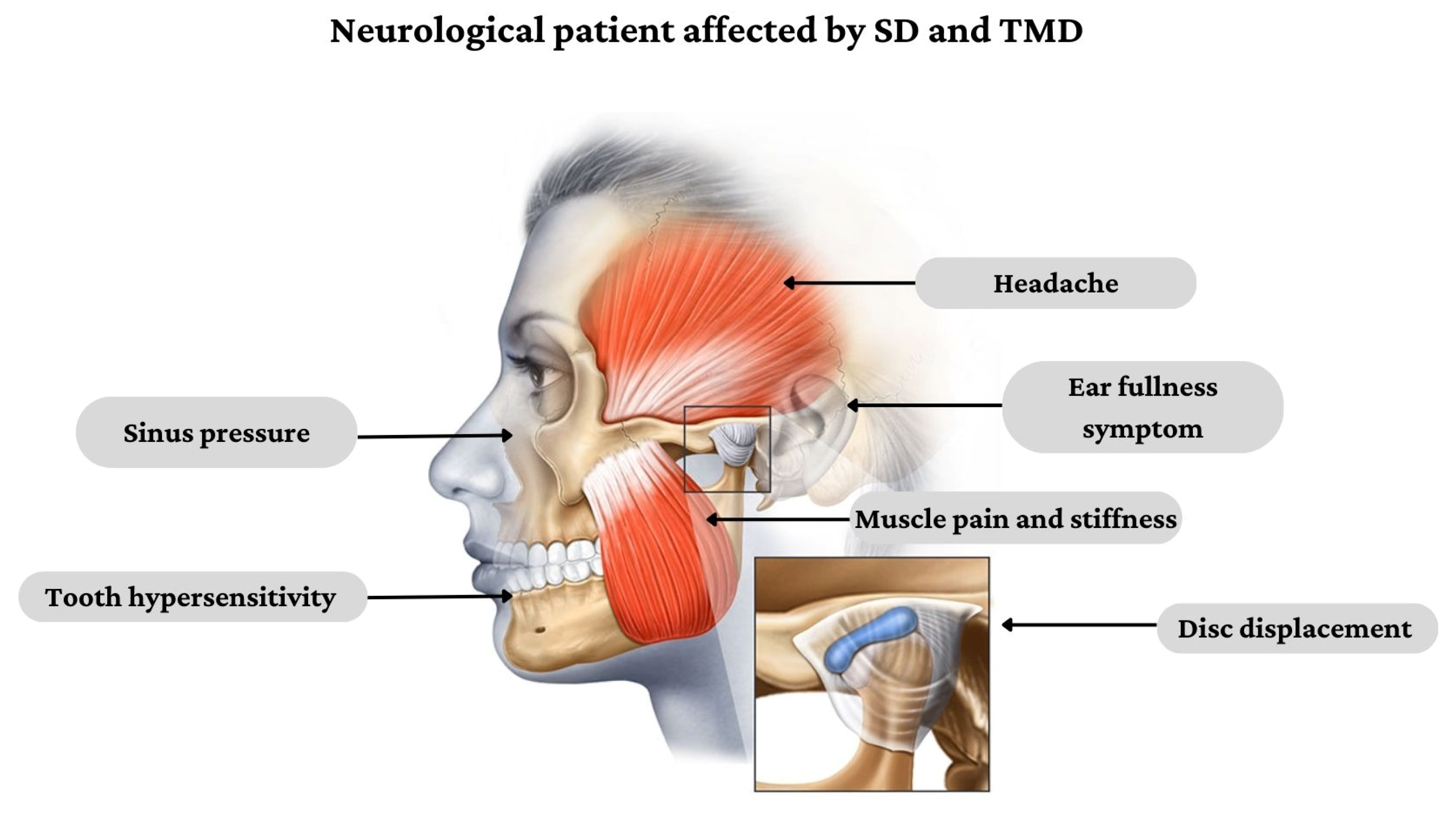 Jcm 12 03528 g001 Jcm 12 03528 g001