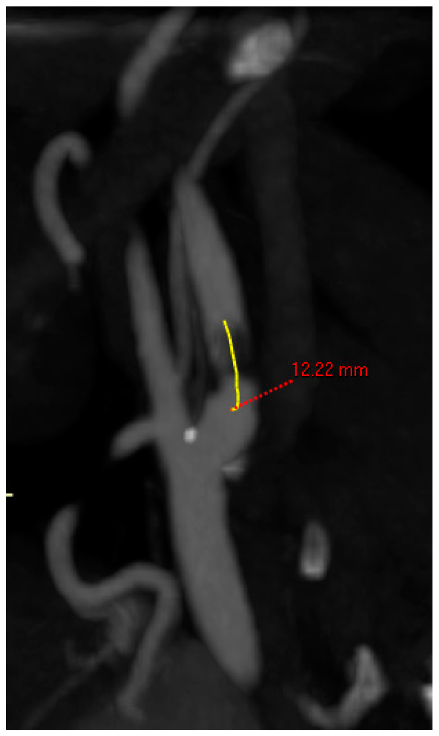 Jcm 12 03534 g002 Jcm 12 03534 g002