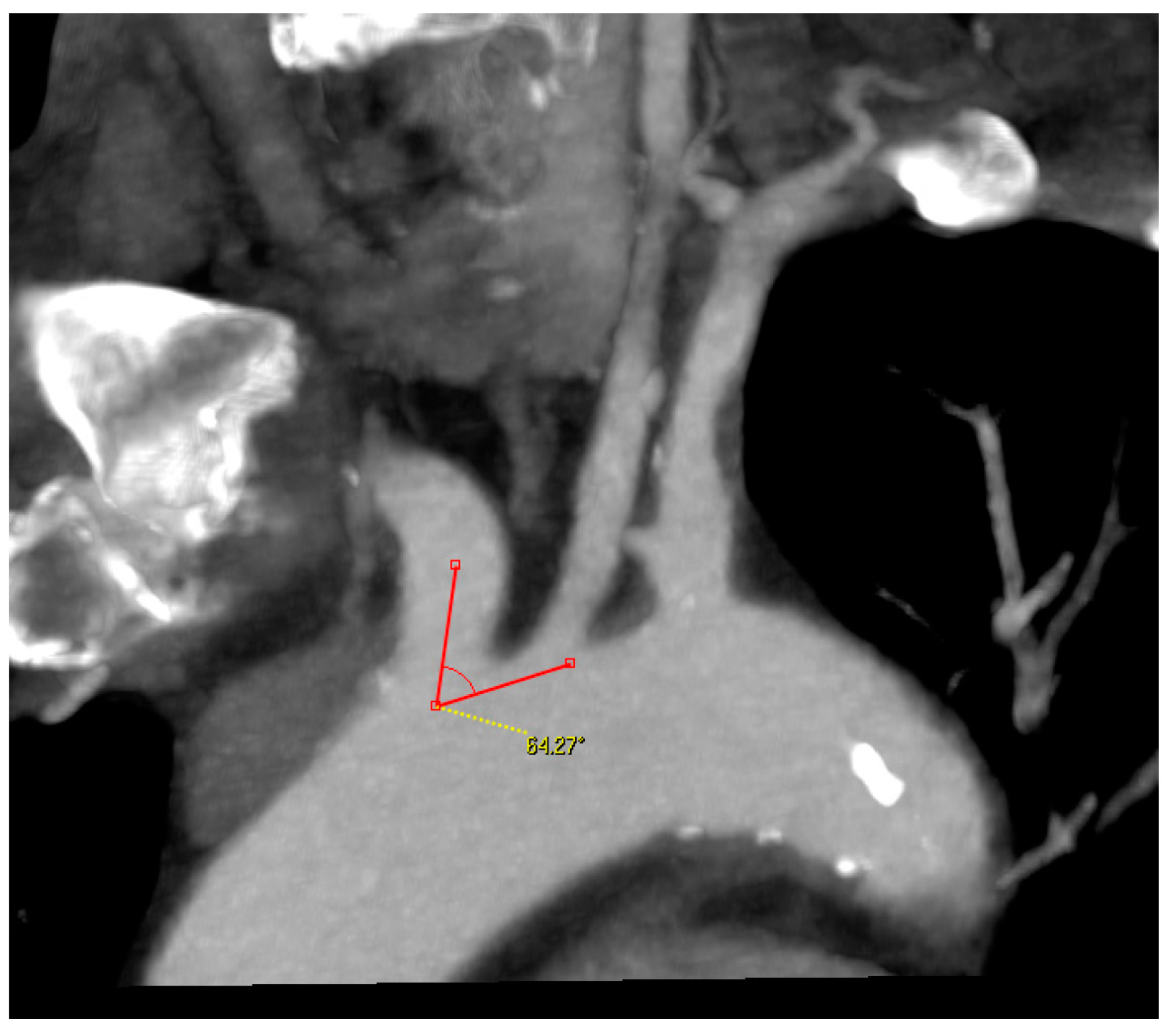 Jcm 12 03534 g003 Jcm 12 03534 g003