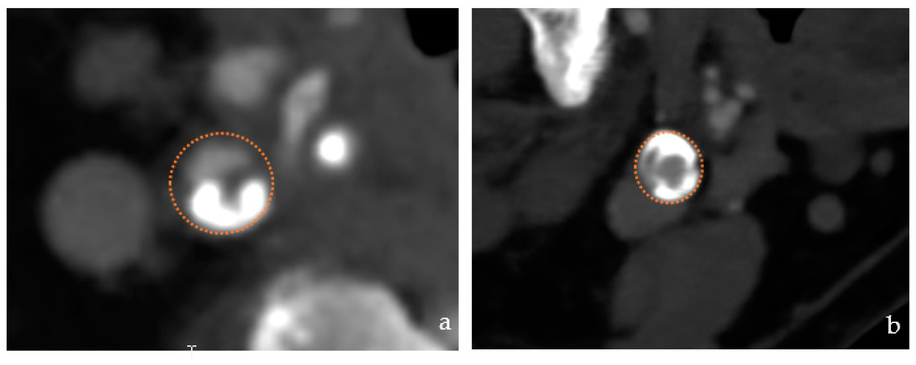 Jcm 12 03534 g005 Jcm 12 03534 g005