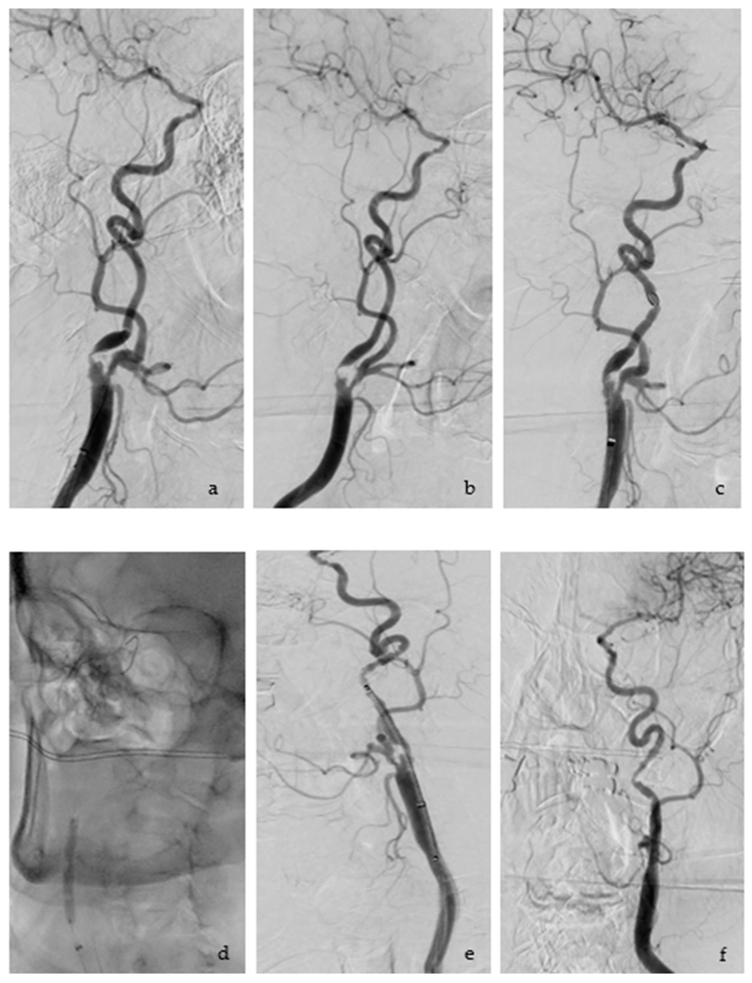 Jcm 12 03534 g006 Jcm 12 03534 g006