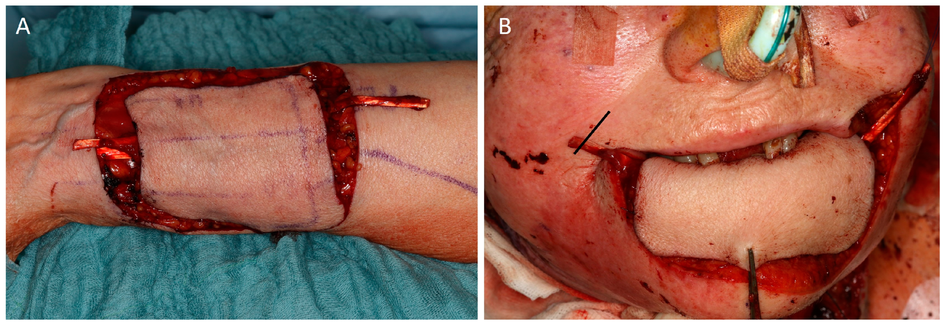 Jcm 12 03636 g001 Jcm 12 03636 g001