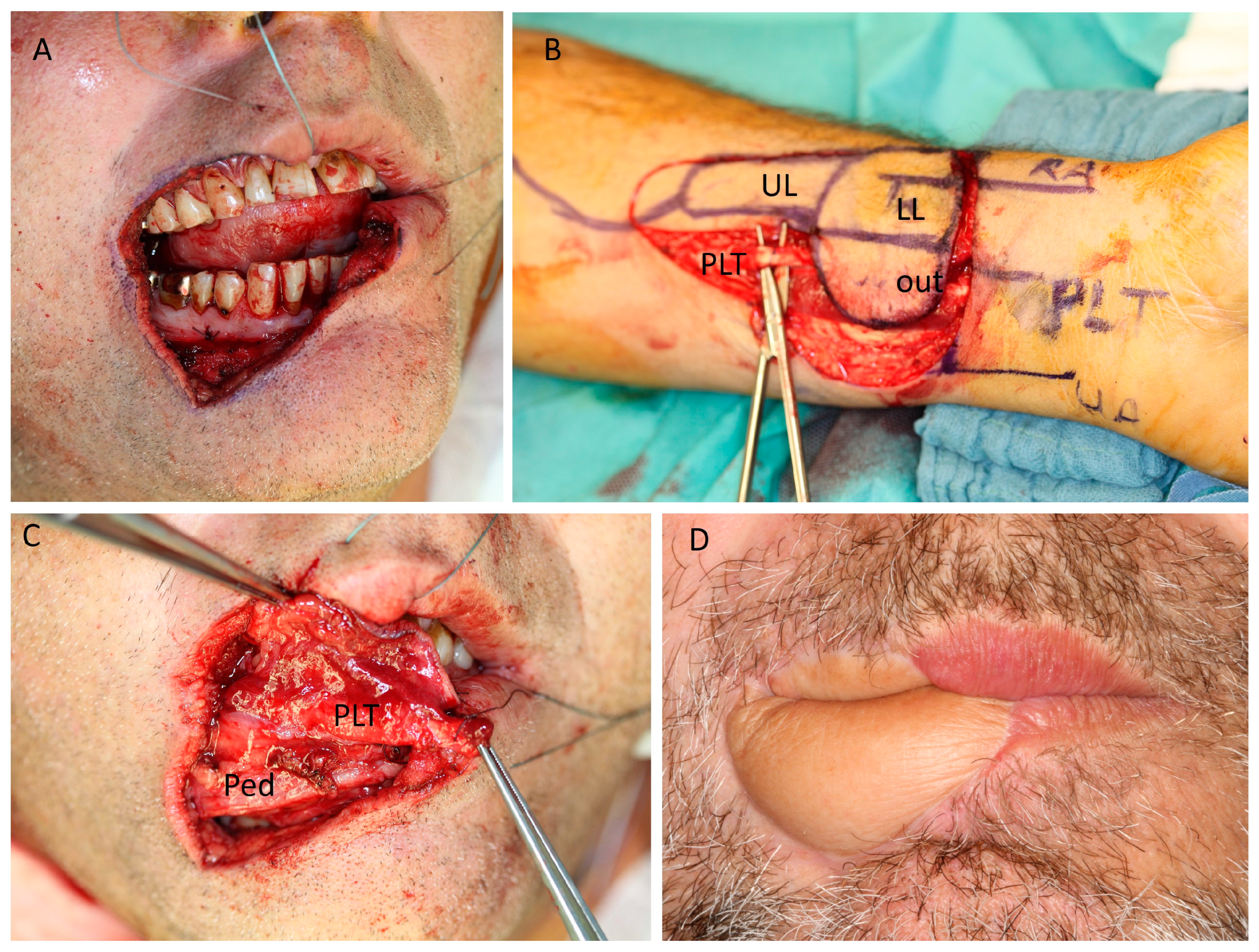 Jcm 12 03636 g002 Jcm 12 03636 g002