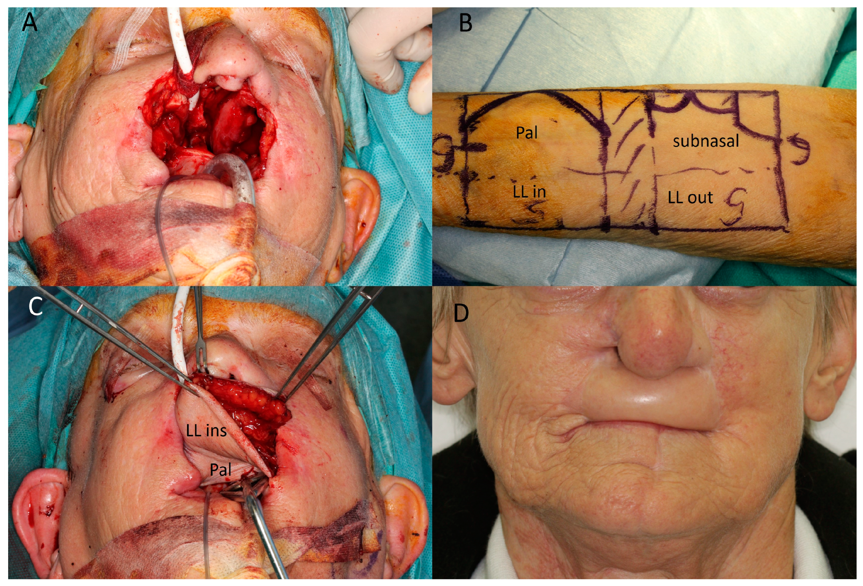 Jcm 12 03636 g003 Jcm 12 03636 g003