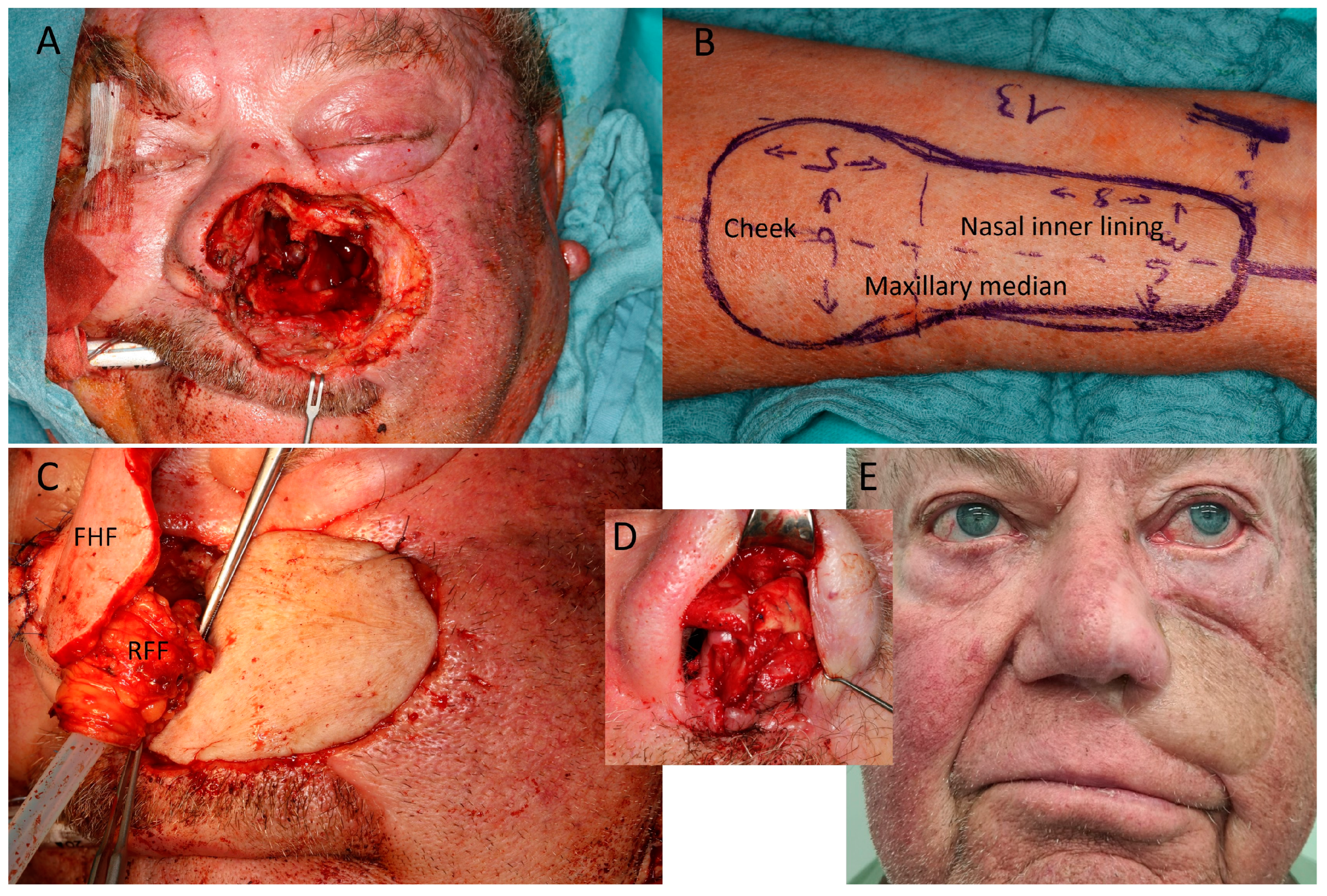 Jcm 12 03636 g004 Jcm 12 03636 g004