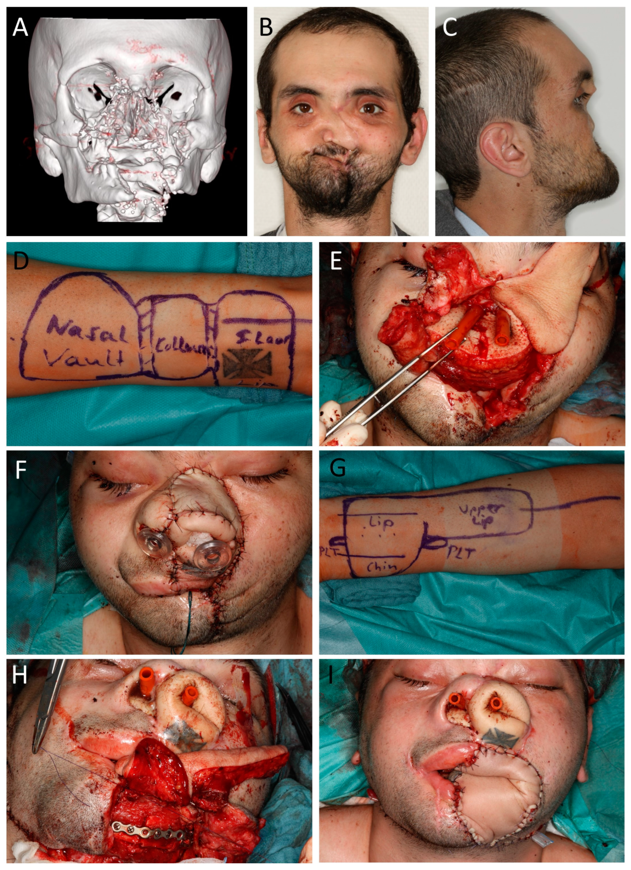 Jcm 12 03636 g005 Jcm 12 03636 g005