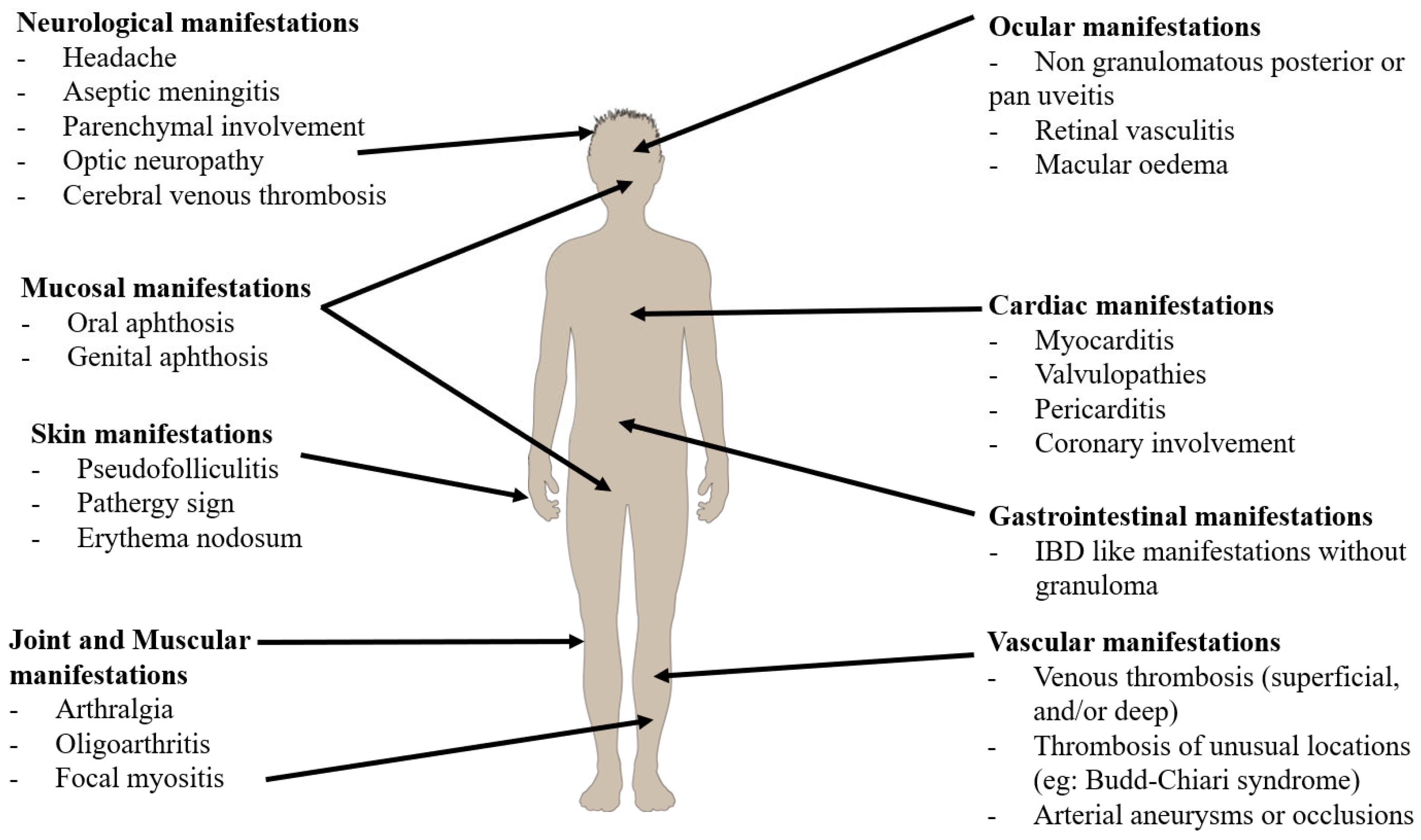 JCM | Free Full-Text | Behçet’s Disease Uveitis