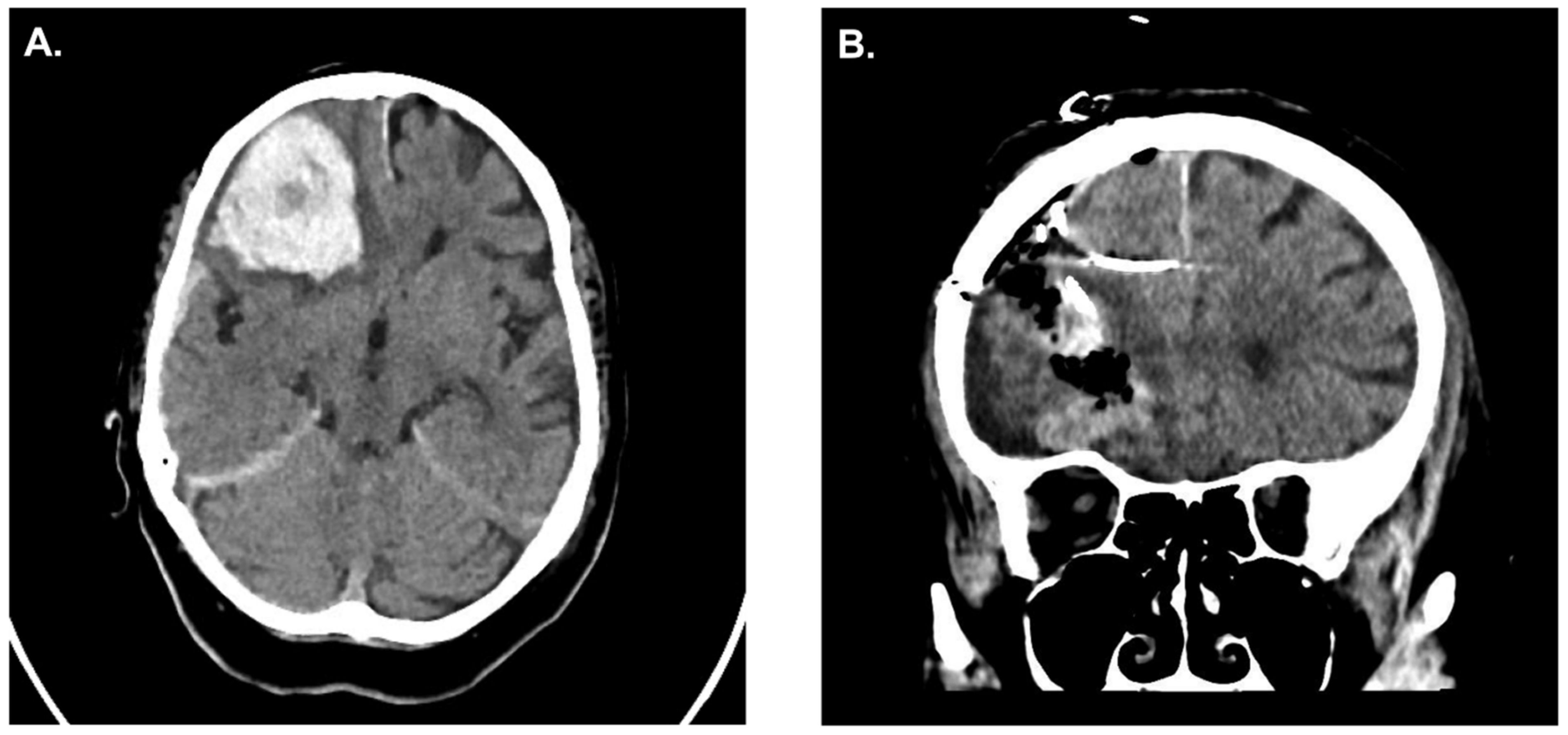 Jcm 12 03661 g005 Jcm 12 03661 g005