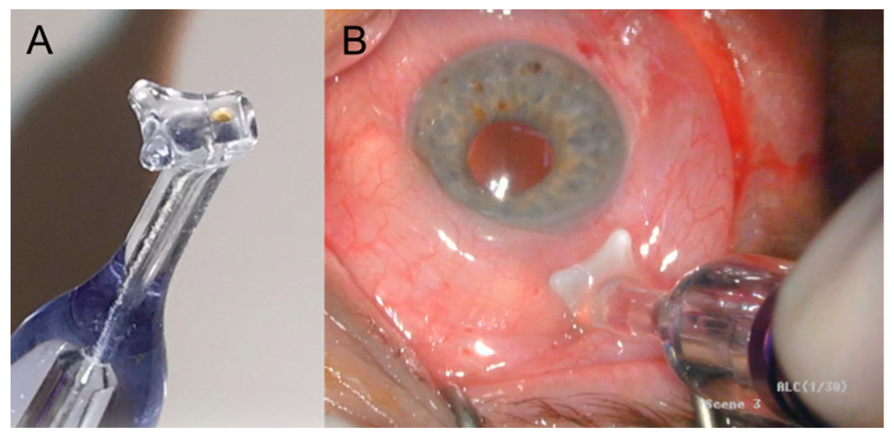 Jcm 12 03680 g001 Jcm 12 03680 g001