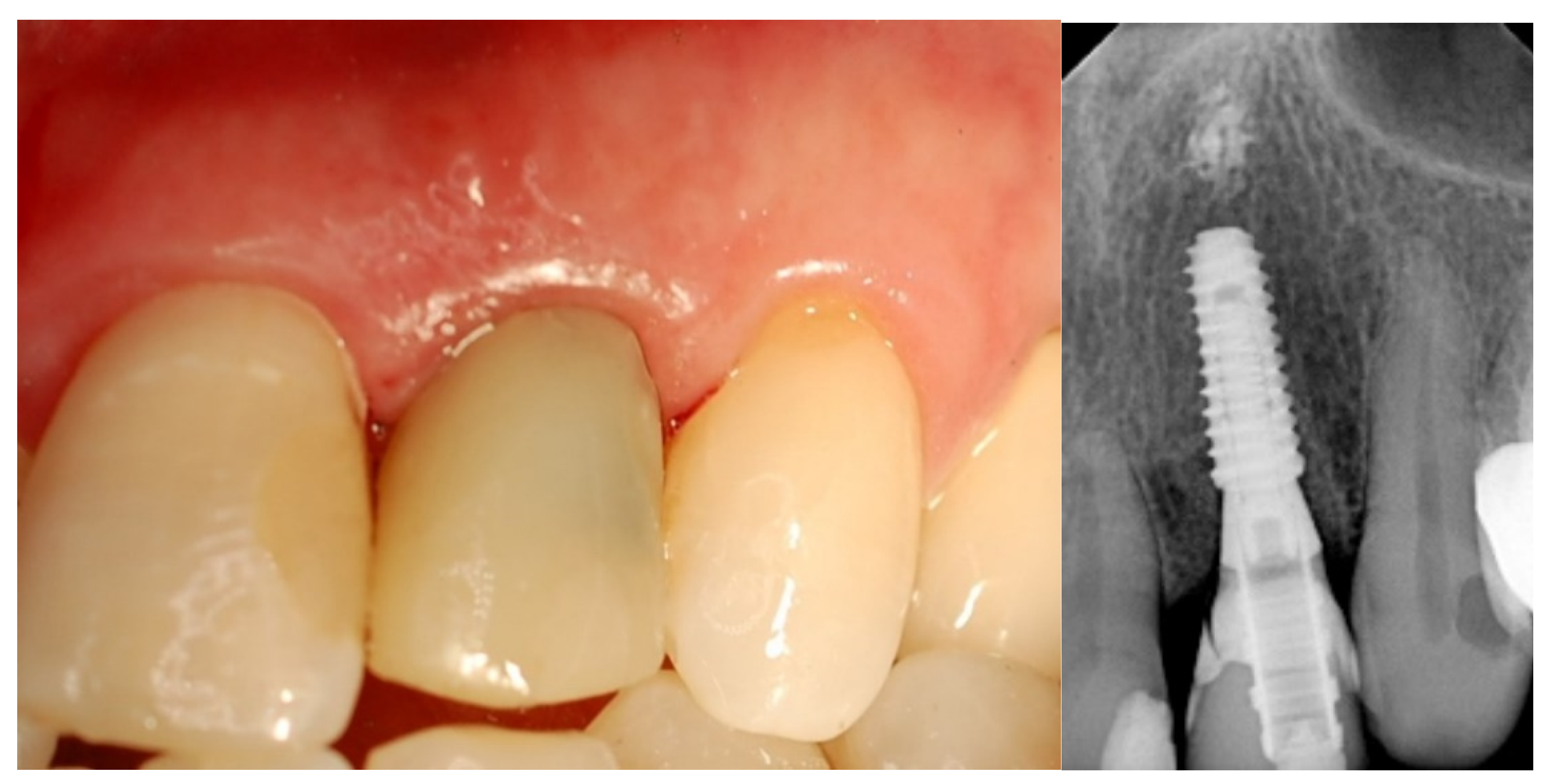 Jcm 12 03711 g003 Jcm 12 03711 g003