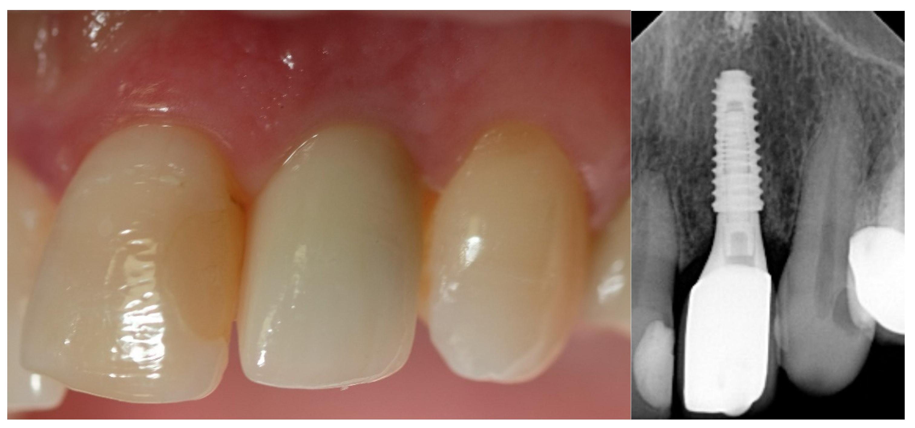 Jcm 12 03711 g004 Jcm 12 03711 g004