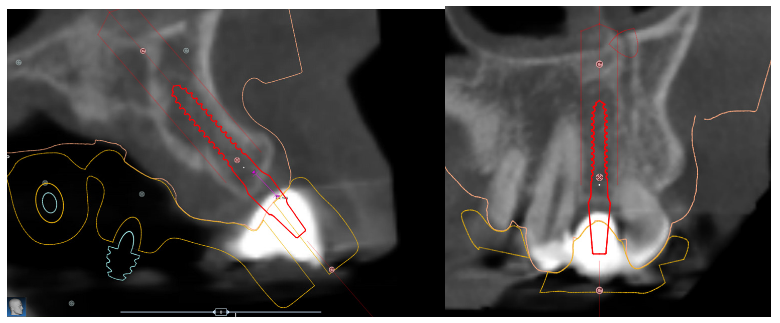 Jcm 12 03711 g006 Jcm 12 03711 g006