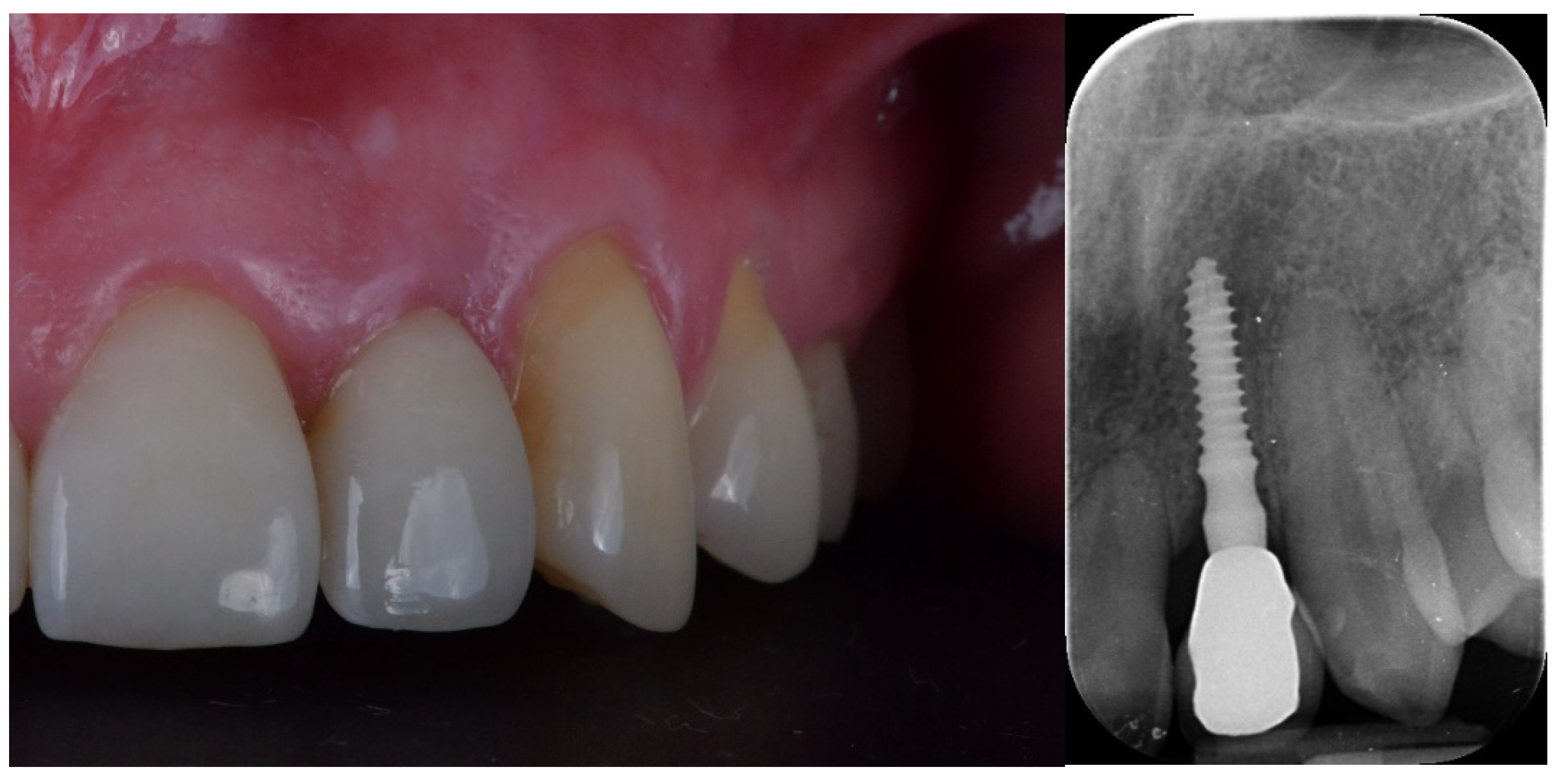 Jcm 12 03711 g009 Jcm 12 03711 g009