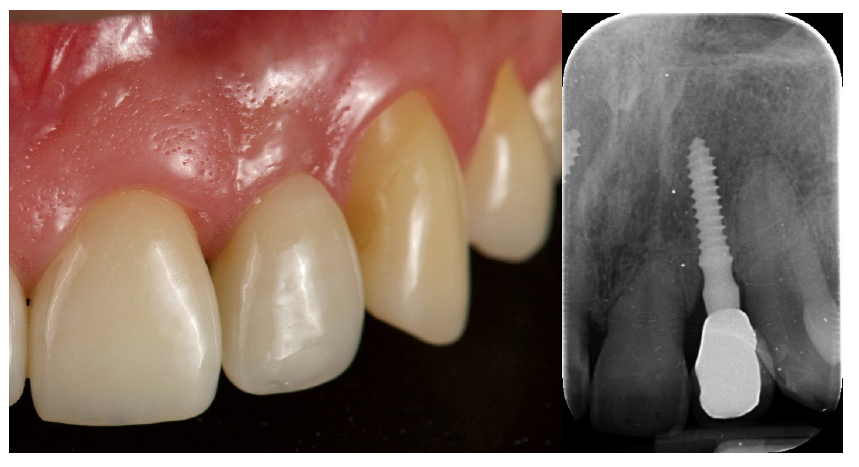 Jcm 12 03711 g010 Jcm 12 03711 g010