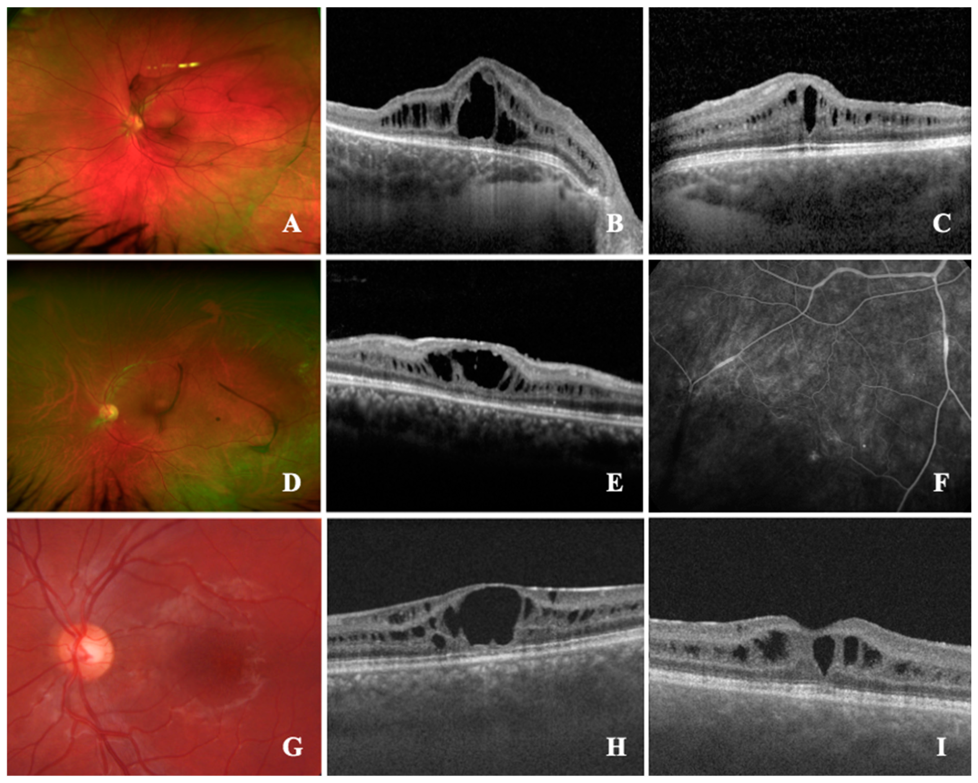 Jcm 12 03729 g001 Jcm 12 03729 g001