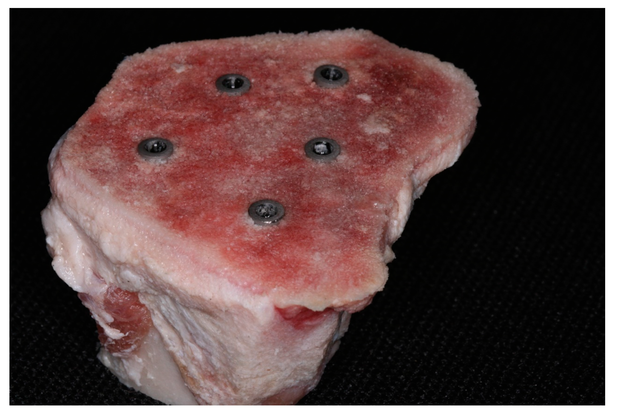 Jcm 12 03736 g003 Jcm 12 03736 g003