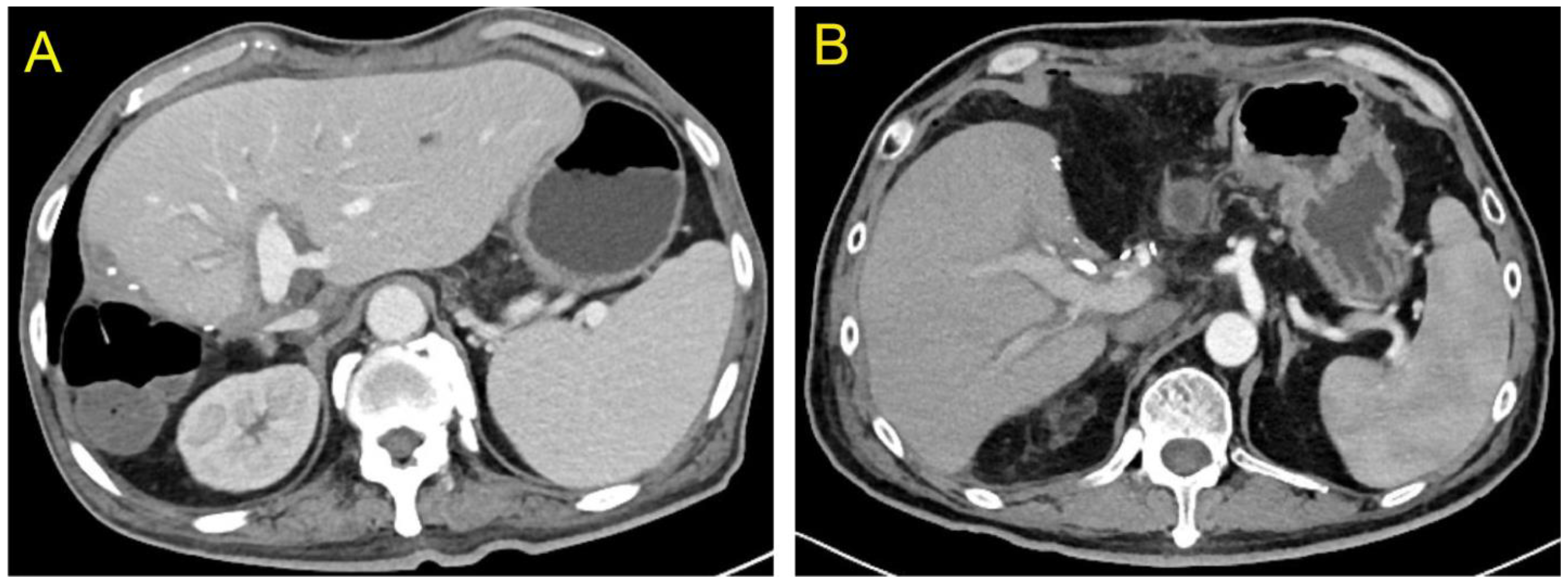 Jcm 12 03782 g004 Jcm 12 03782 g004