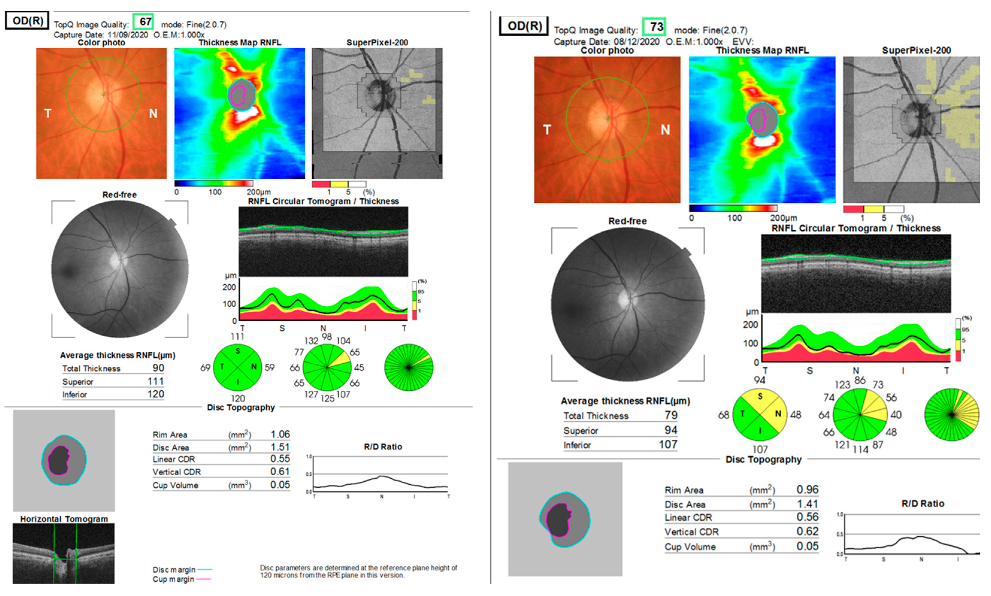 Jcm 12 03795 g004 550