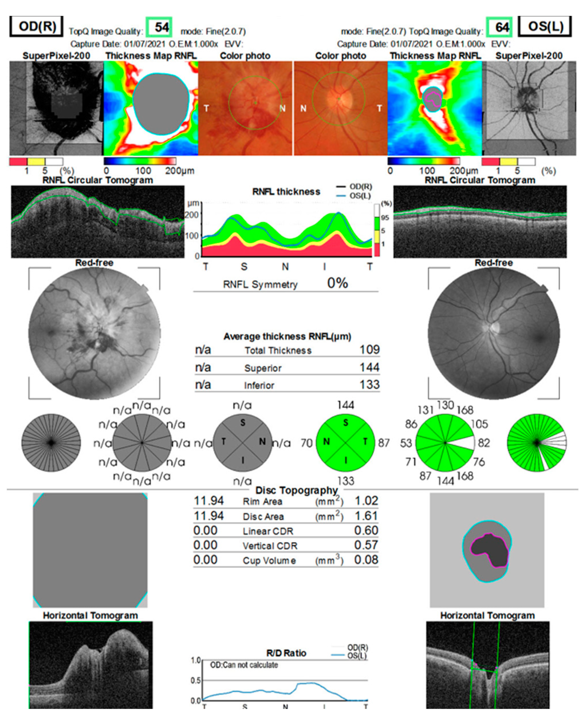 Jcm 12 03795 g007 550