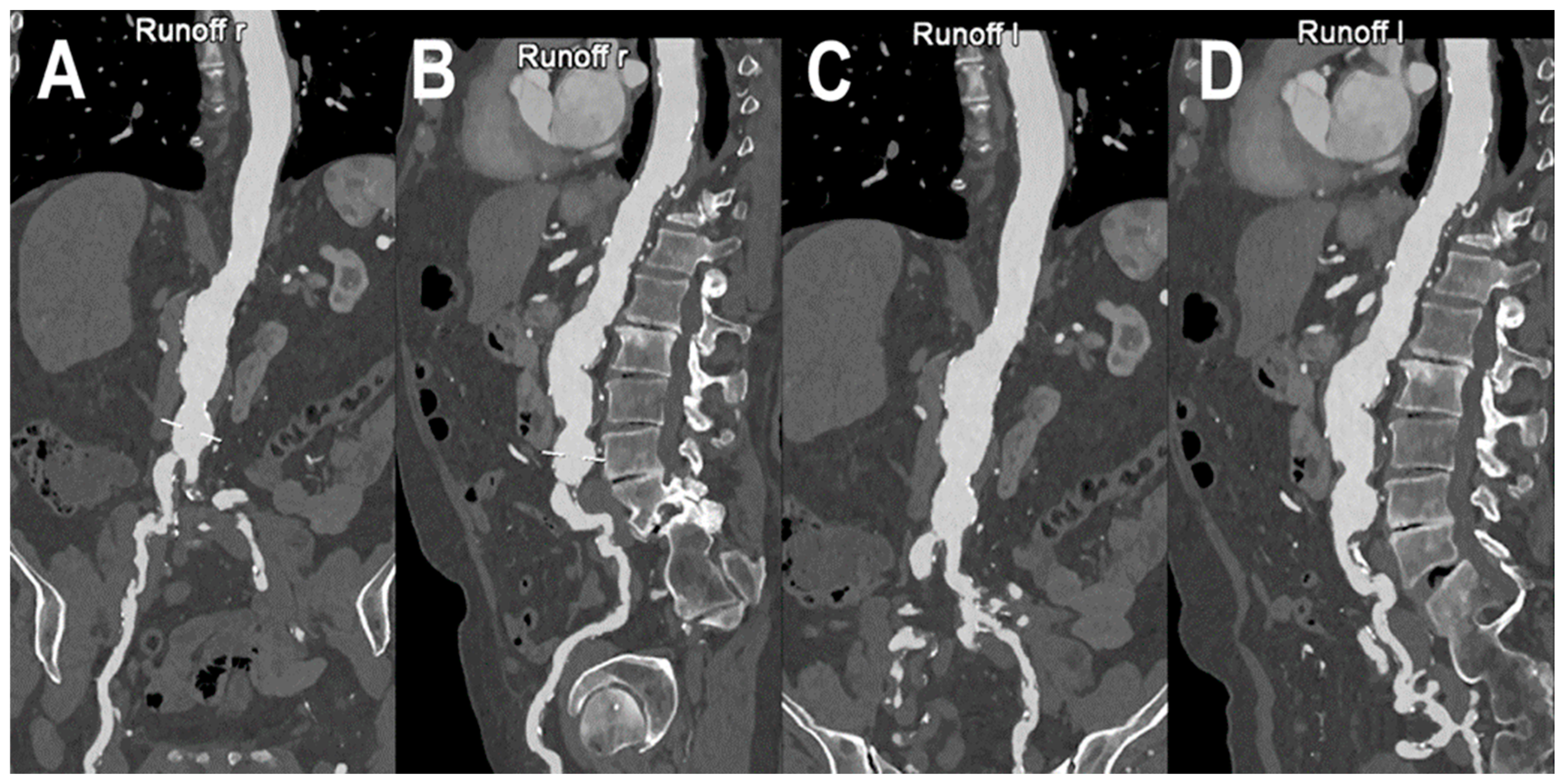 Jcm 12 03798 g004 Jcm 12 03798 g004