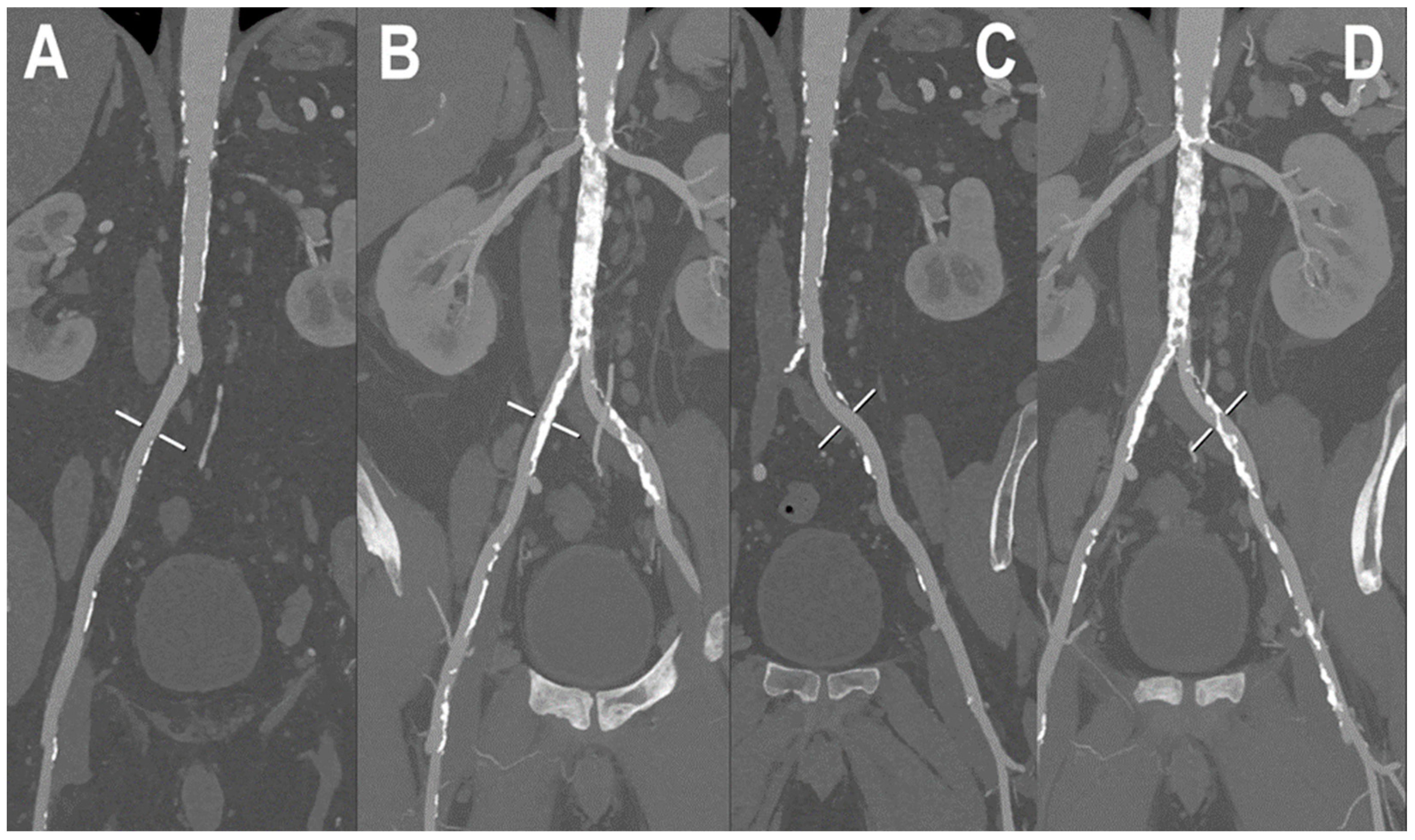 Jcm 12 03798 g005 Jcm 12 03798 g005