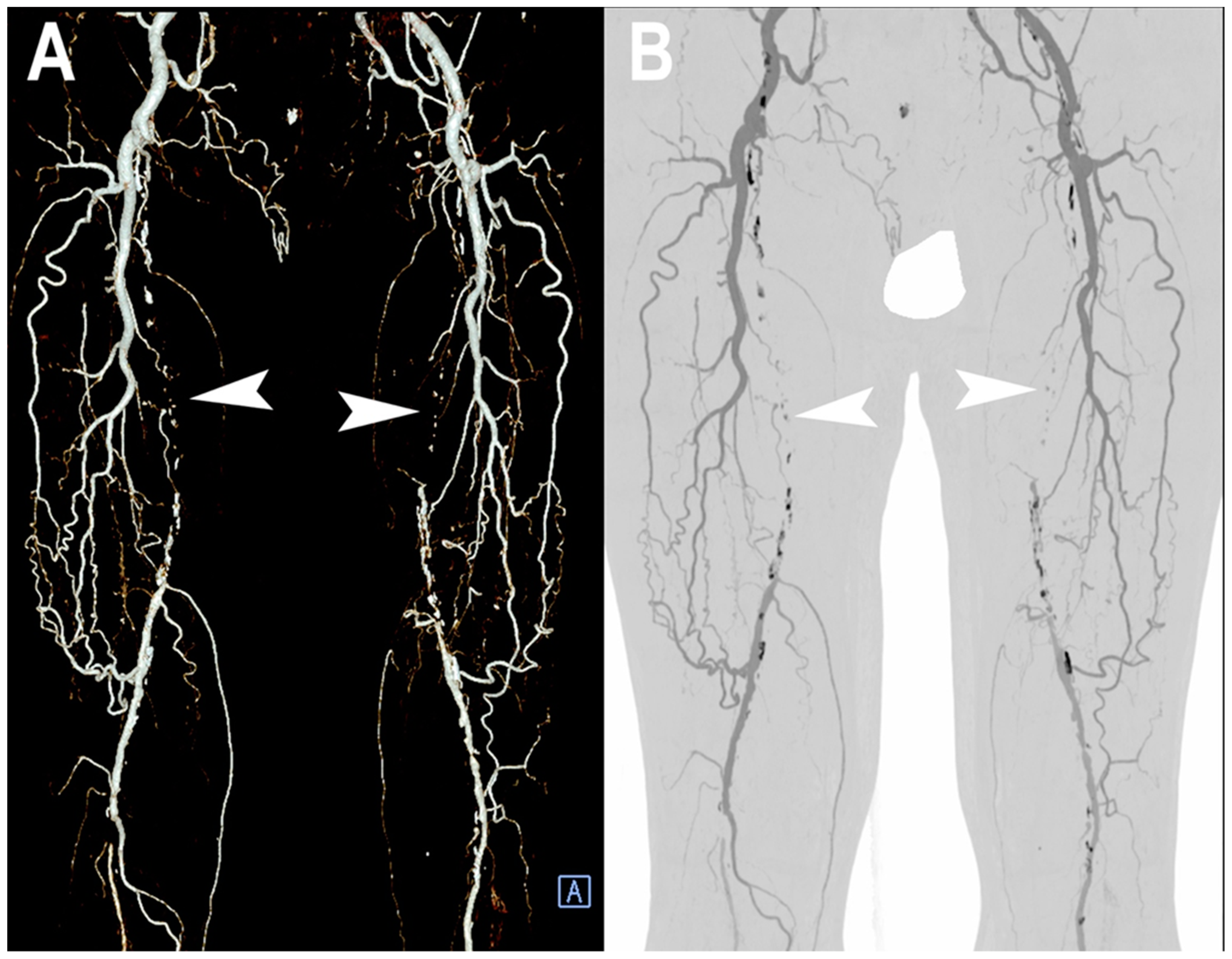 Jcm 12 03798 g007 Jcm 12 03798 g007