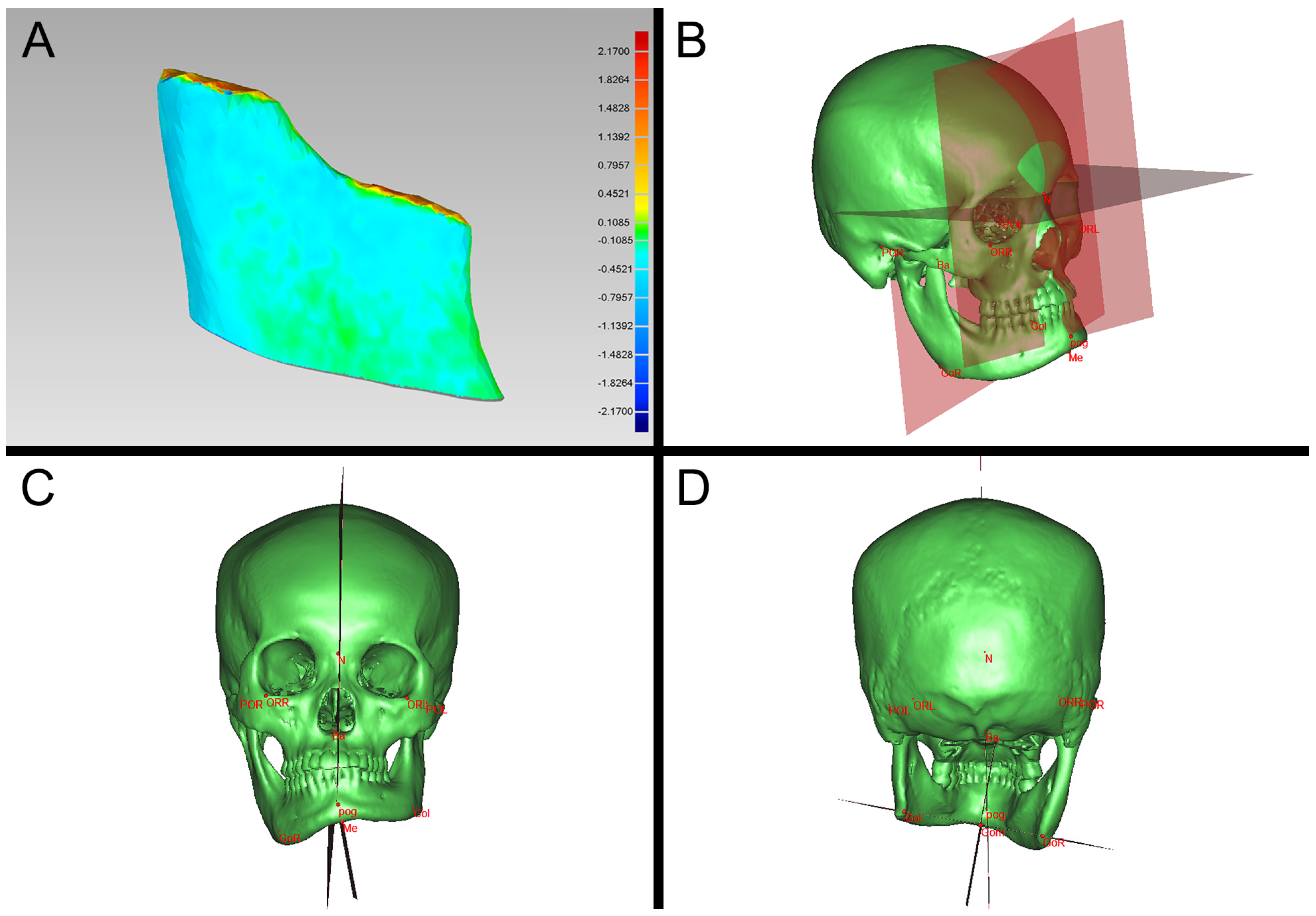 Jcm 12 03816 g003 550