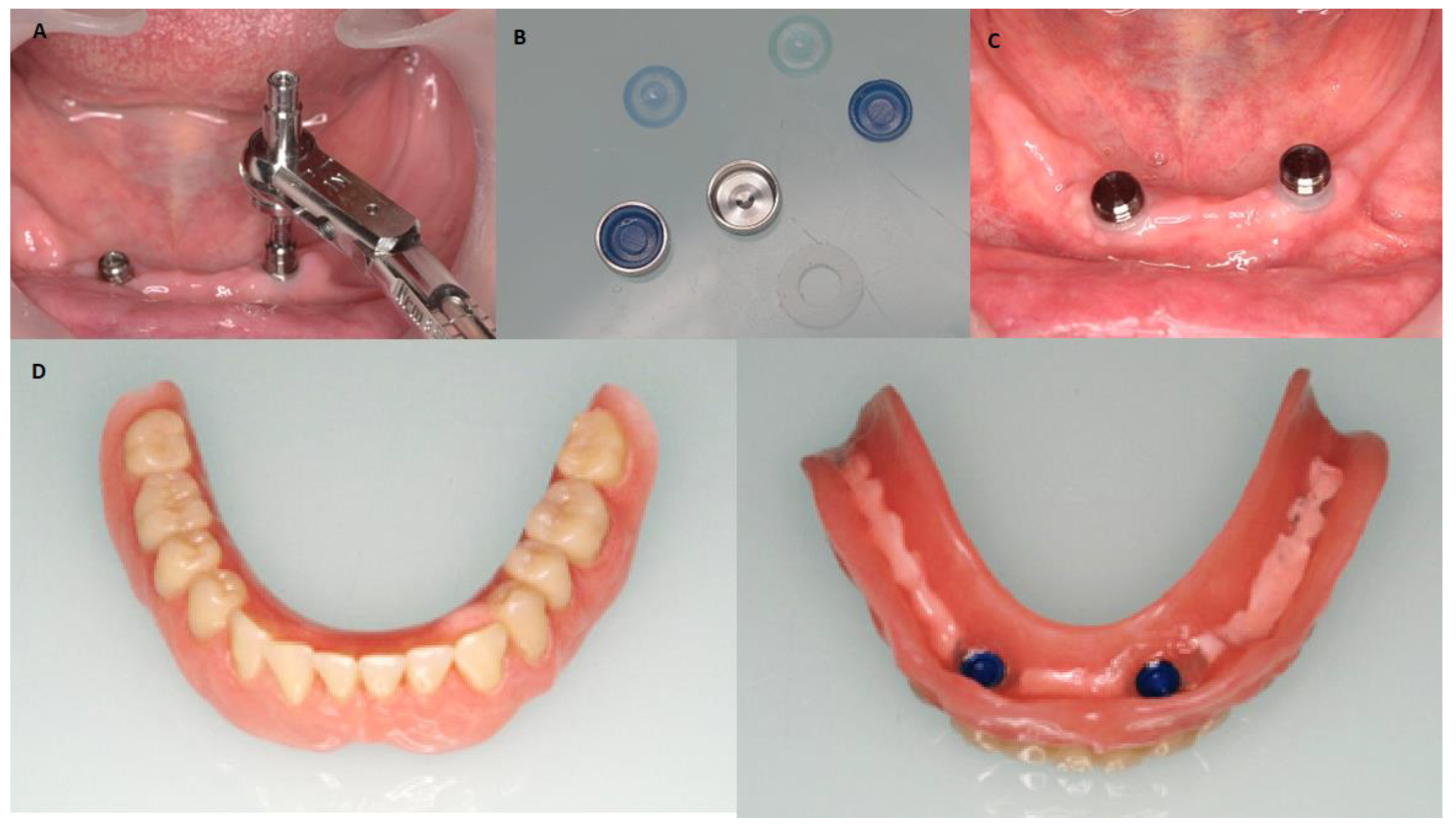 Jcm 12 03825 g003 Jcm 12 03825 g003