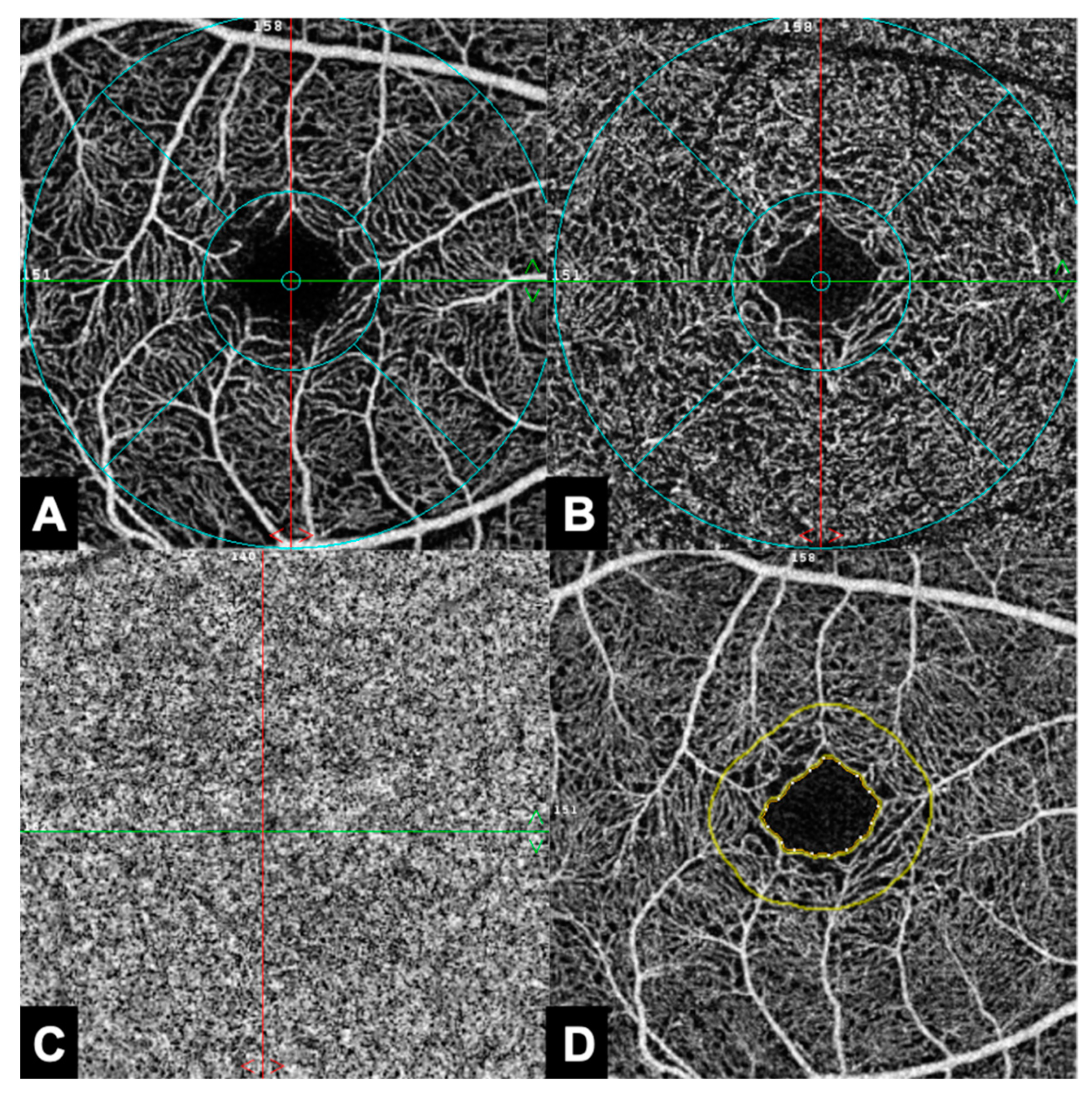 Jcm 12 03836 g001 Jcm 12 03836 g001