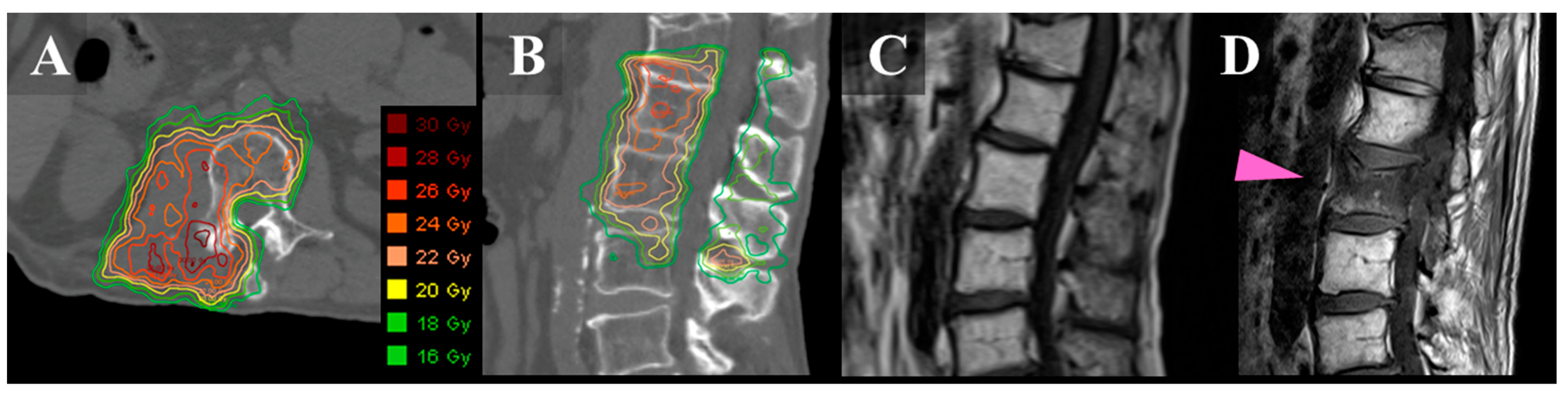 JCM Free FullText Incidence and Prognostic Factors of Painful