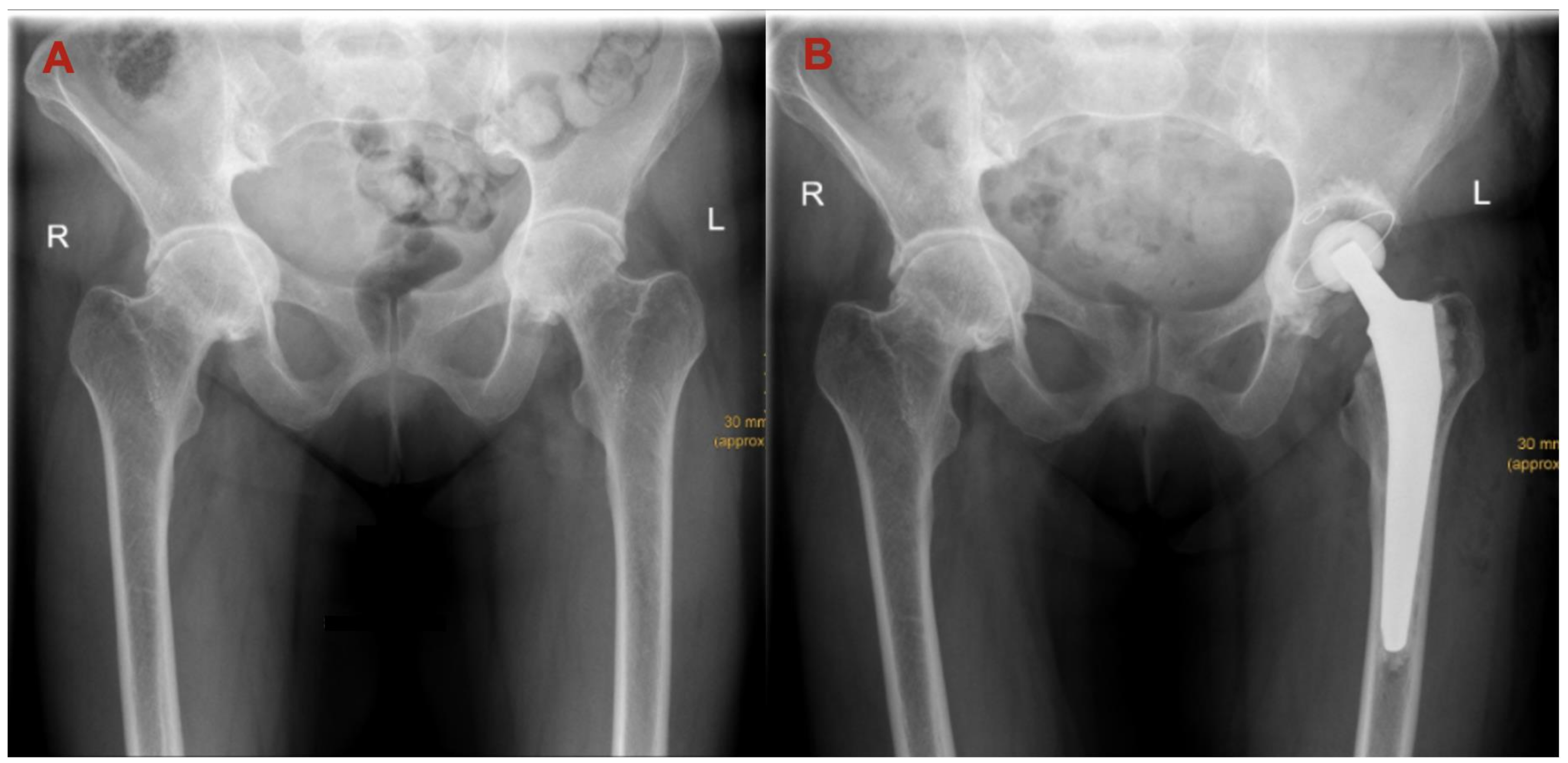 Jcm 12 03941 g003 Jcm 12 03941 g003