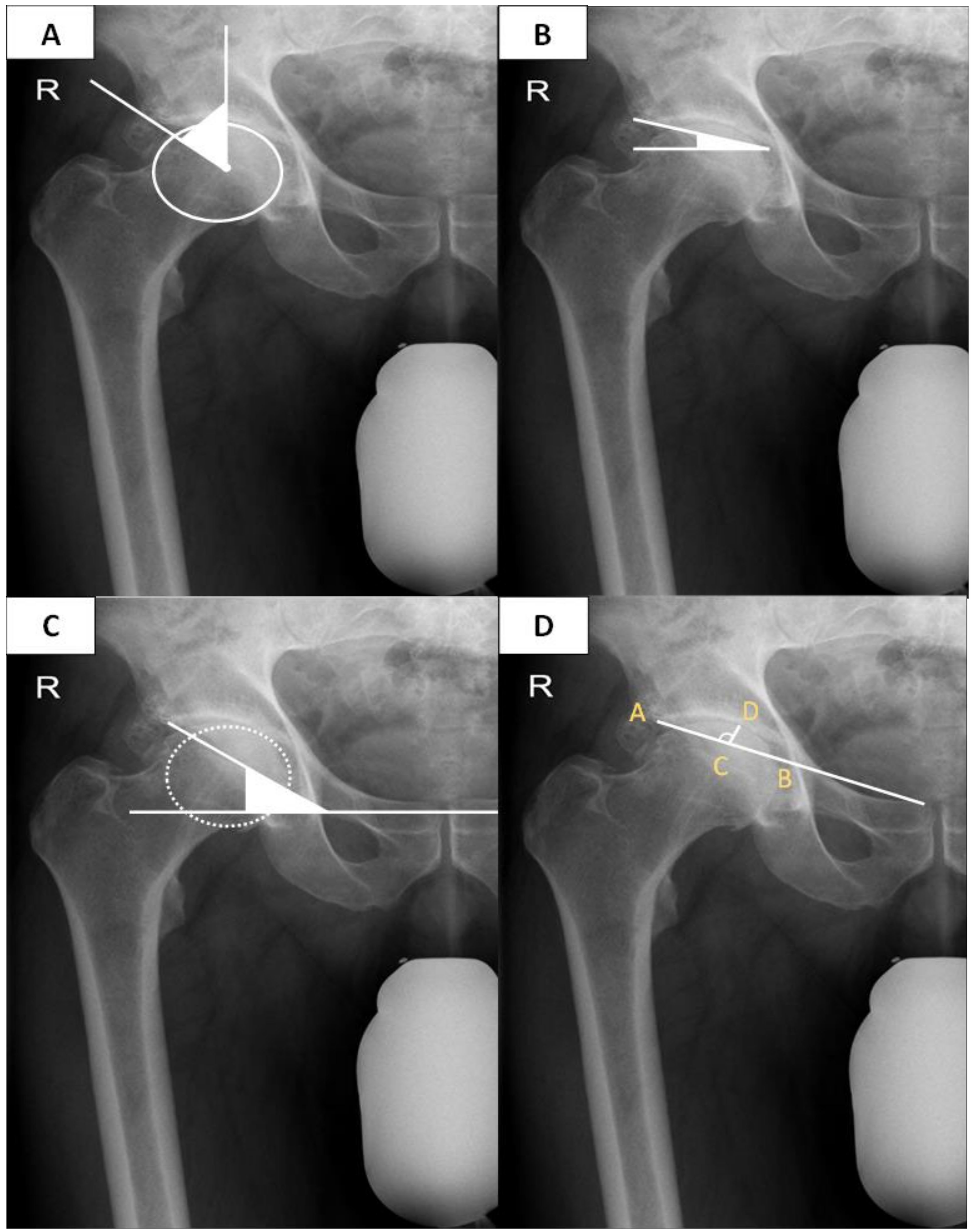 Jcm 12 03941 g004 Jcm 12 03941 g004