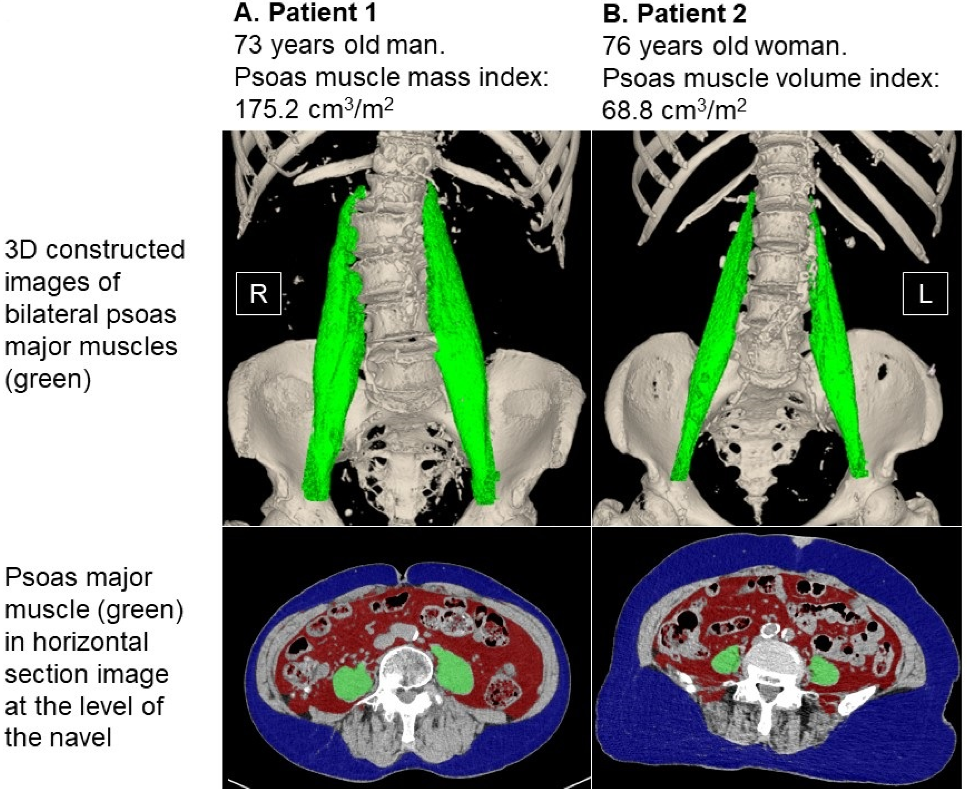 Jcm 12 03943 g005 Jcm 12 03943 g005
