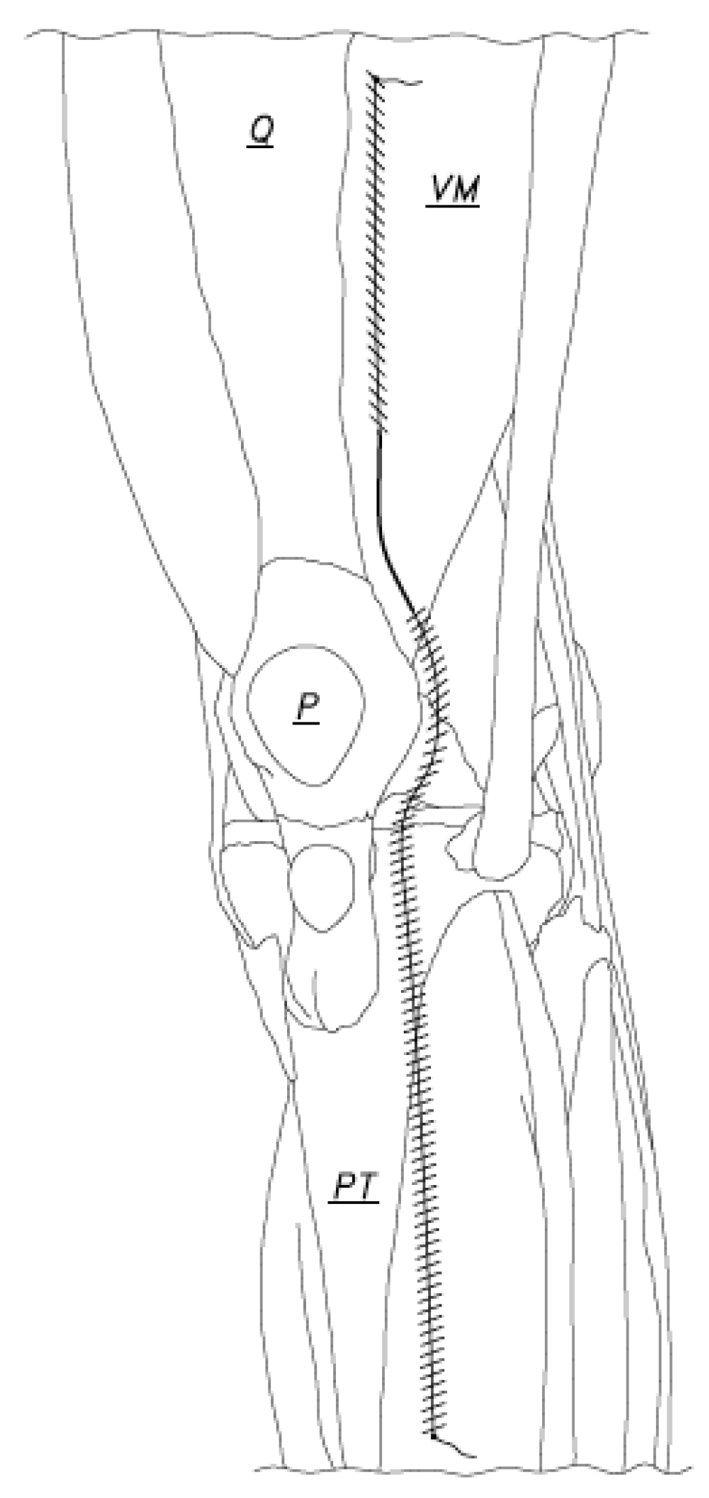 JCM Free FullText WaterTight Arthrotomy Joint Closure of Modified